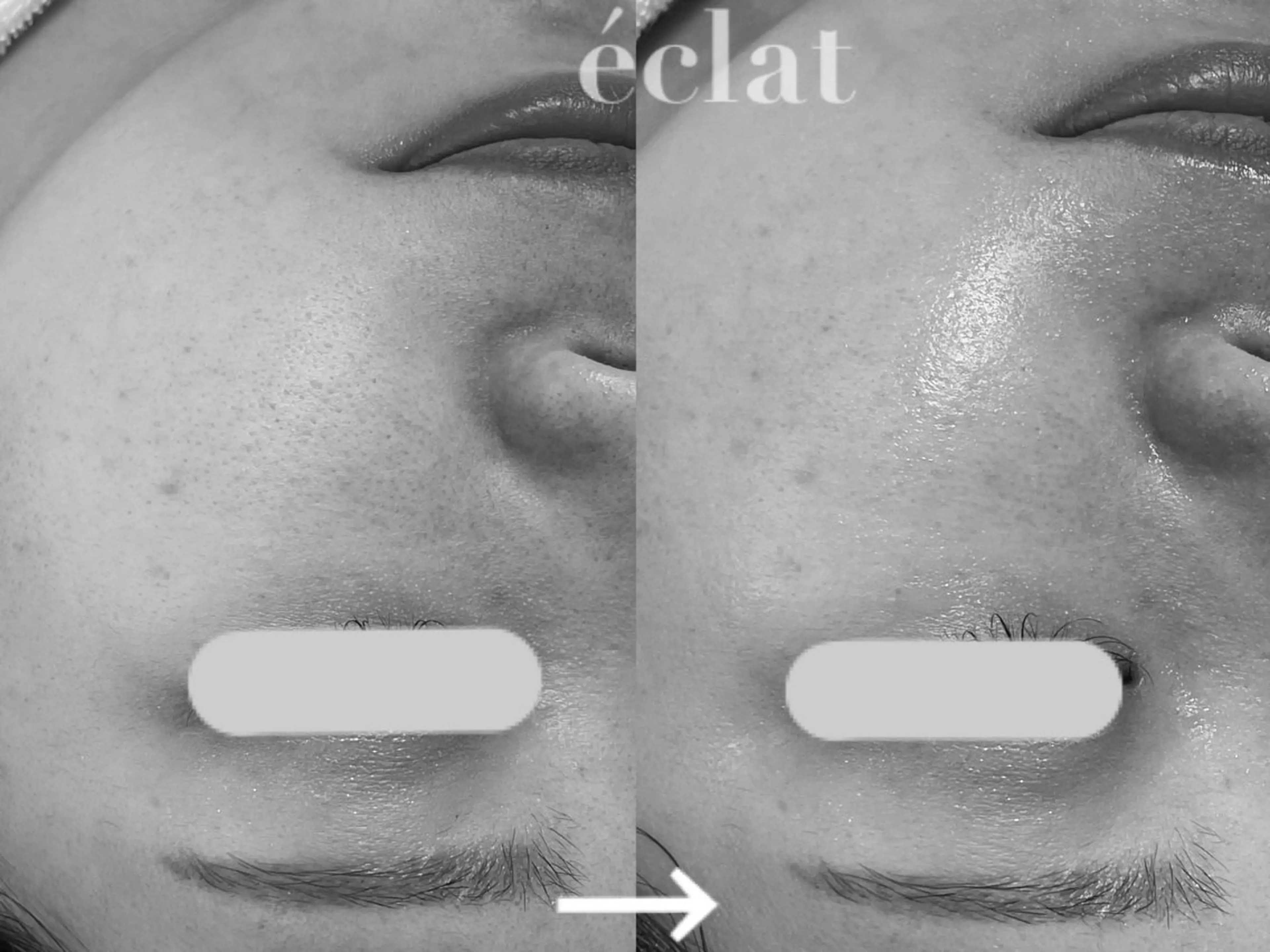 private salon éclat所属・ニキビ・毛穴専門 éclat/エクラのエステ・リラクイメージ