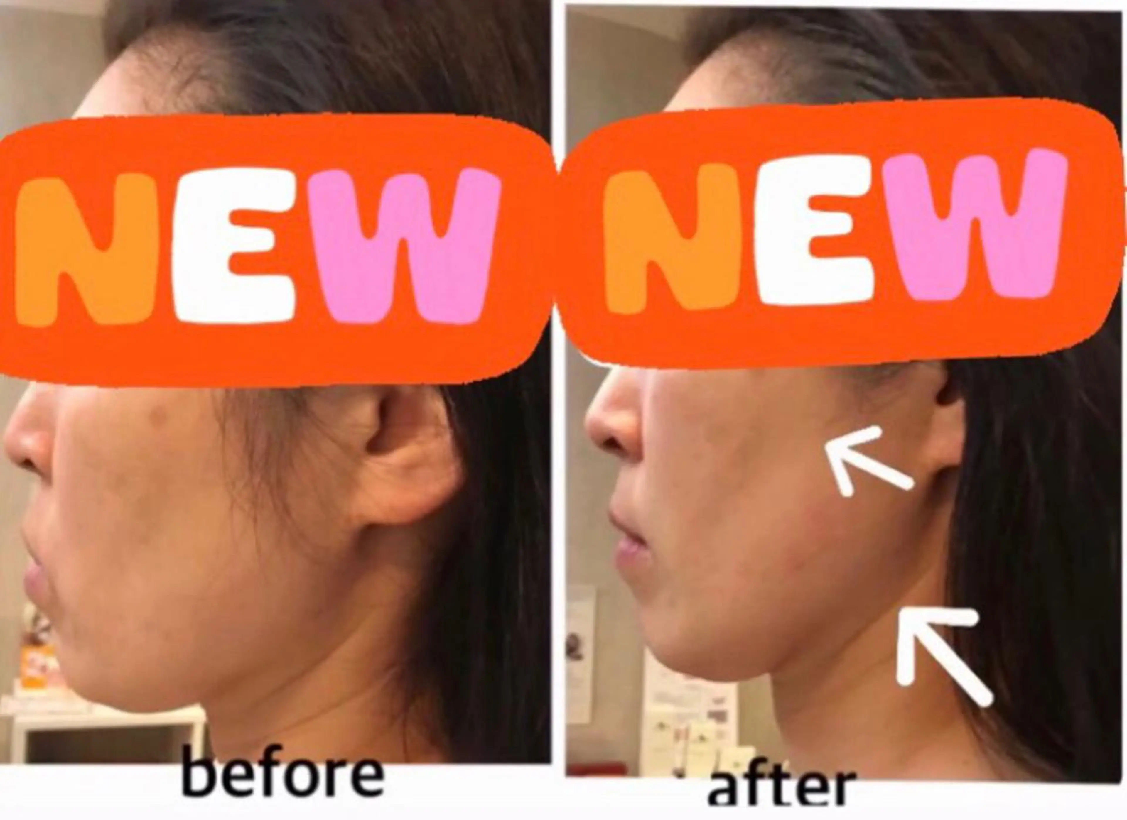 アクシア ビューティー サロン所属・究極のアンチエイ ジングサロンのエステ・リラクイメージ