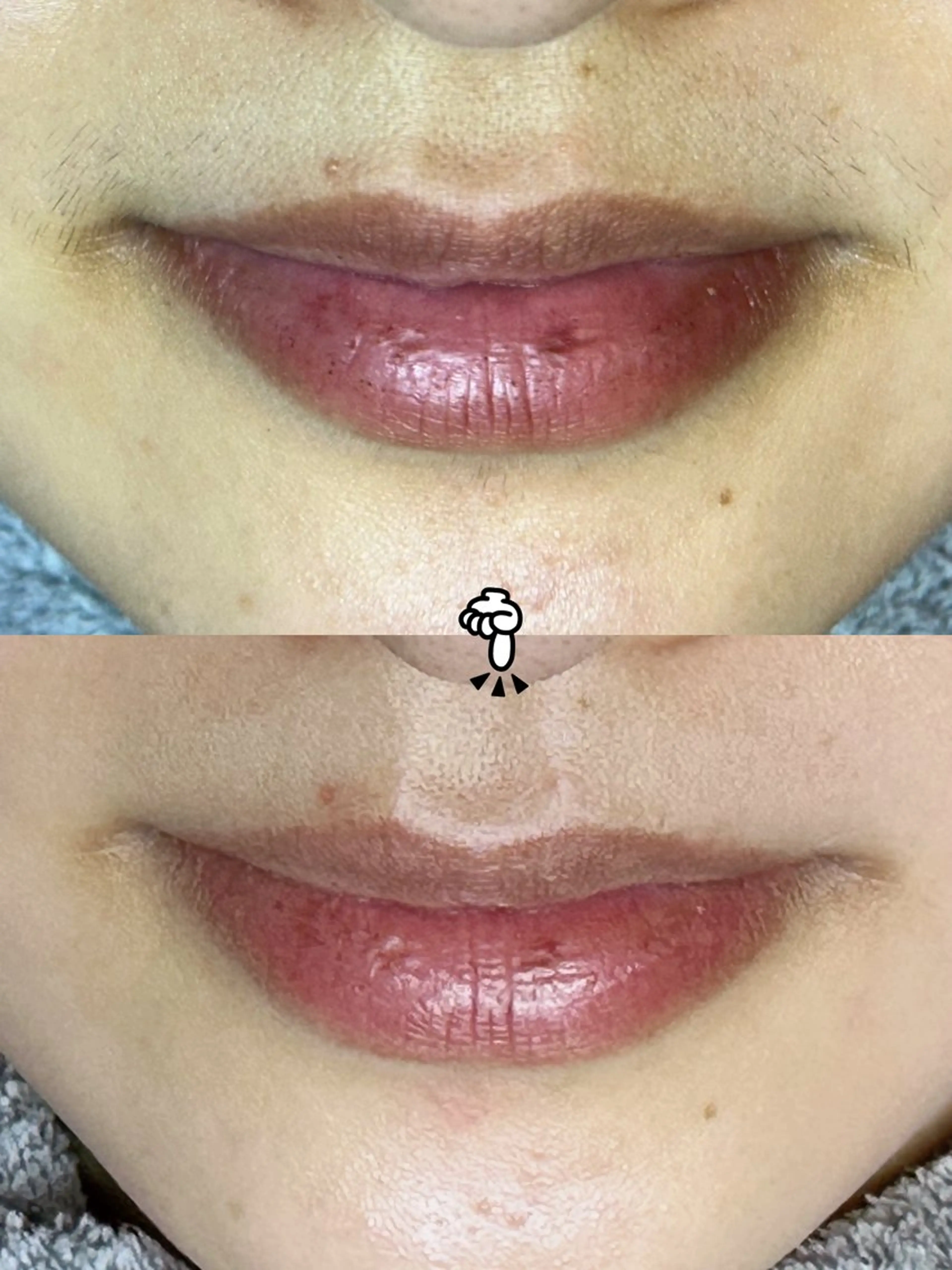 Hit. シュガーリング豊橋のエステ・リラクイメージ