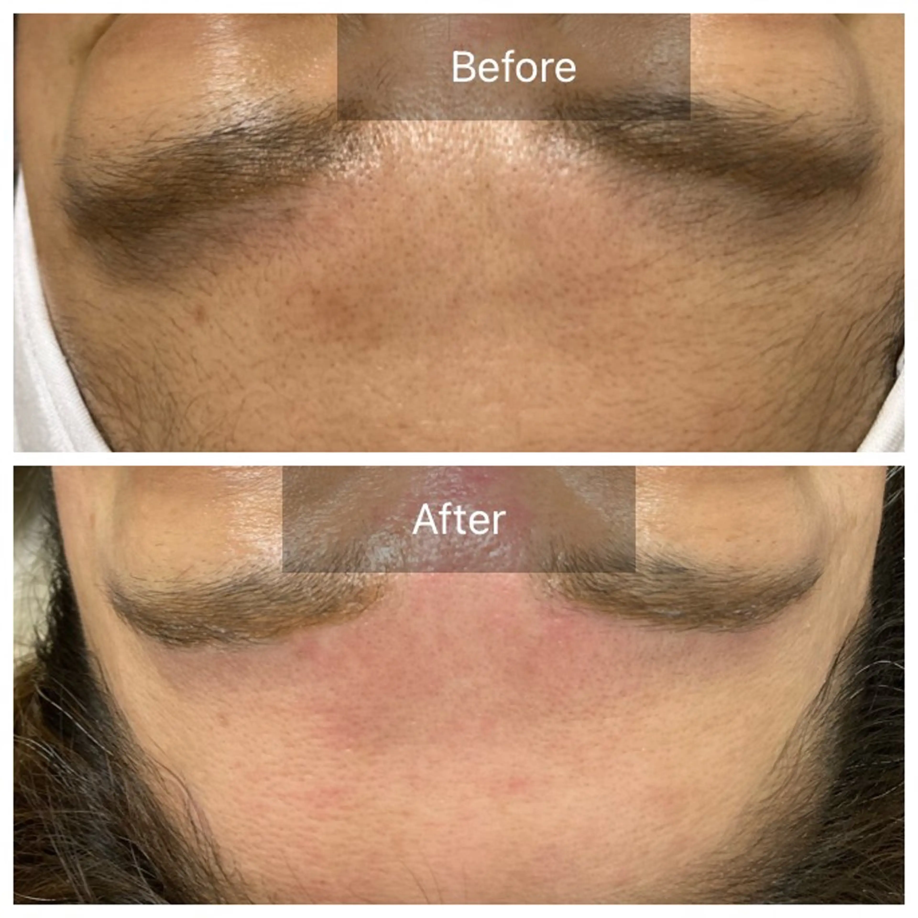 脱毛 産毛専門店 Bittoのエステ・リラクイメージ