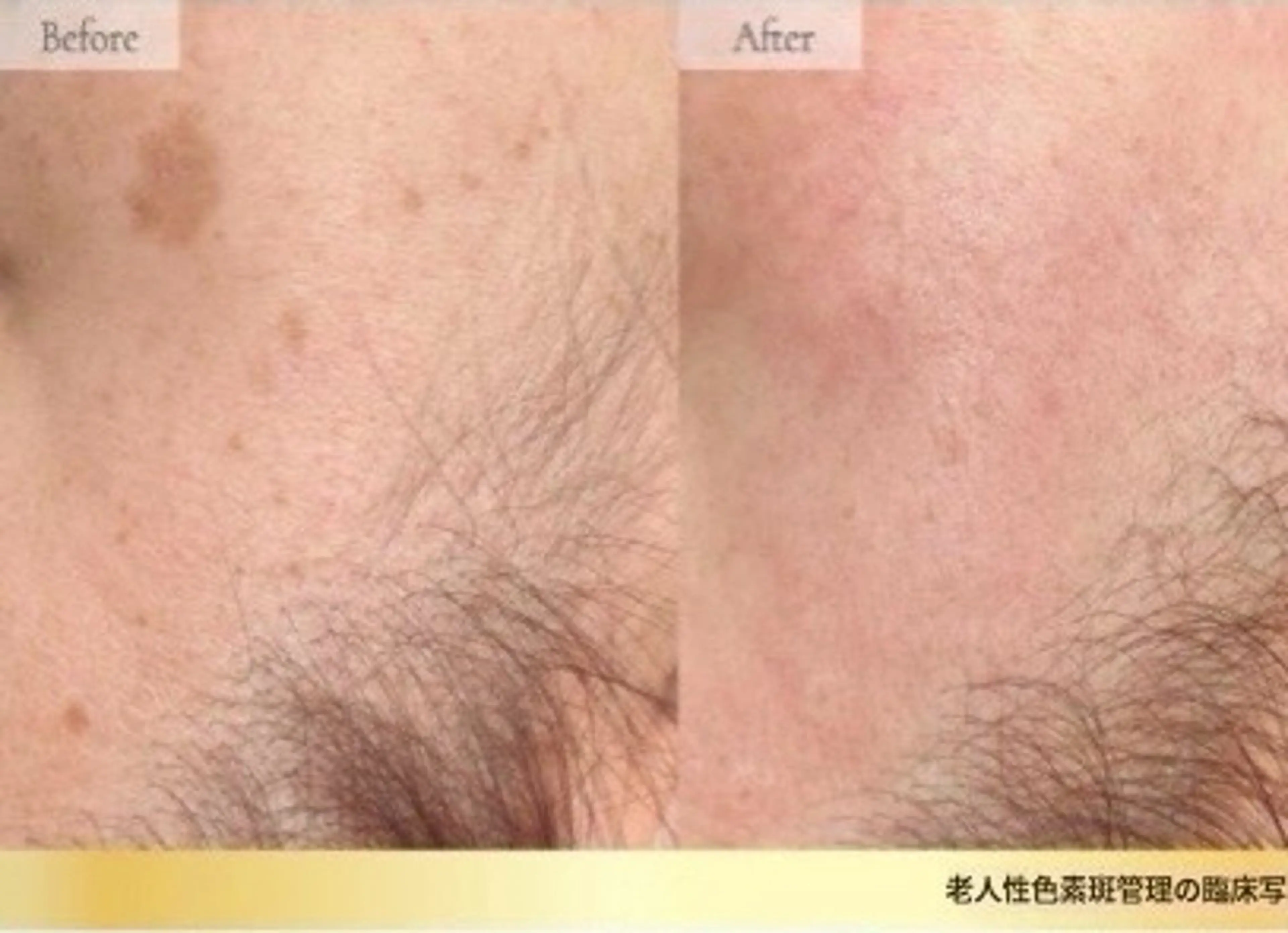 amor Beautyのマツエク・マツパデザイン