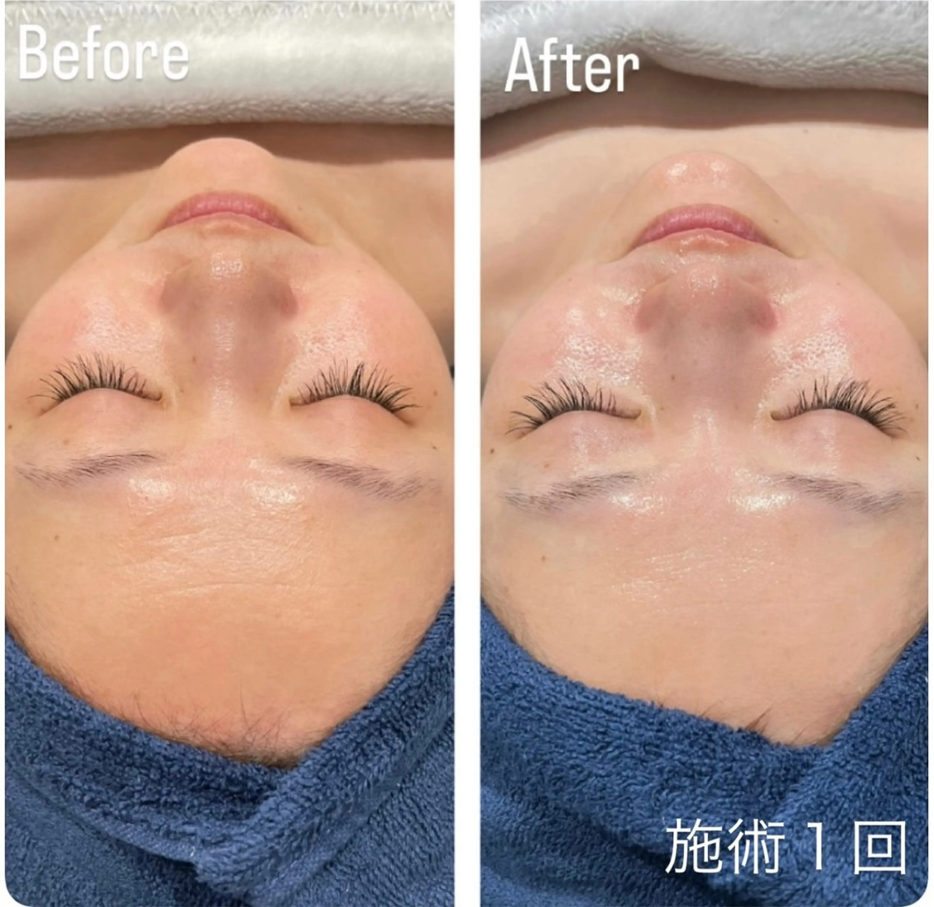 アンド ミルルのエステ・リラクイメージ