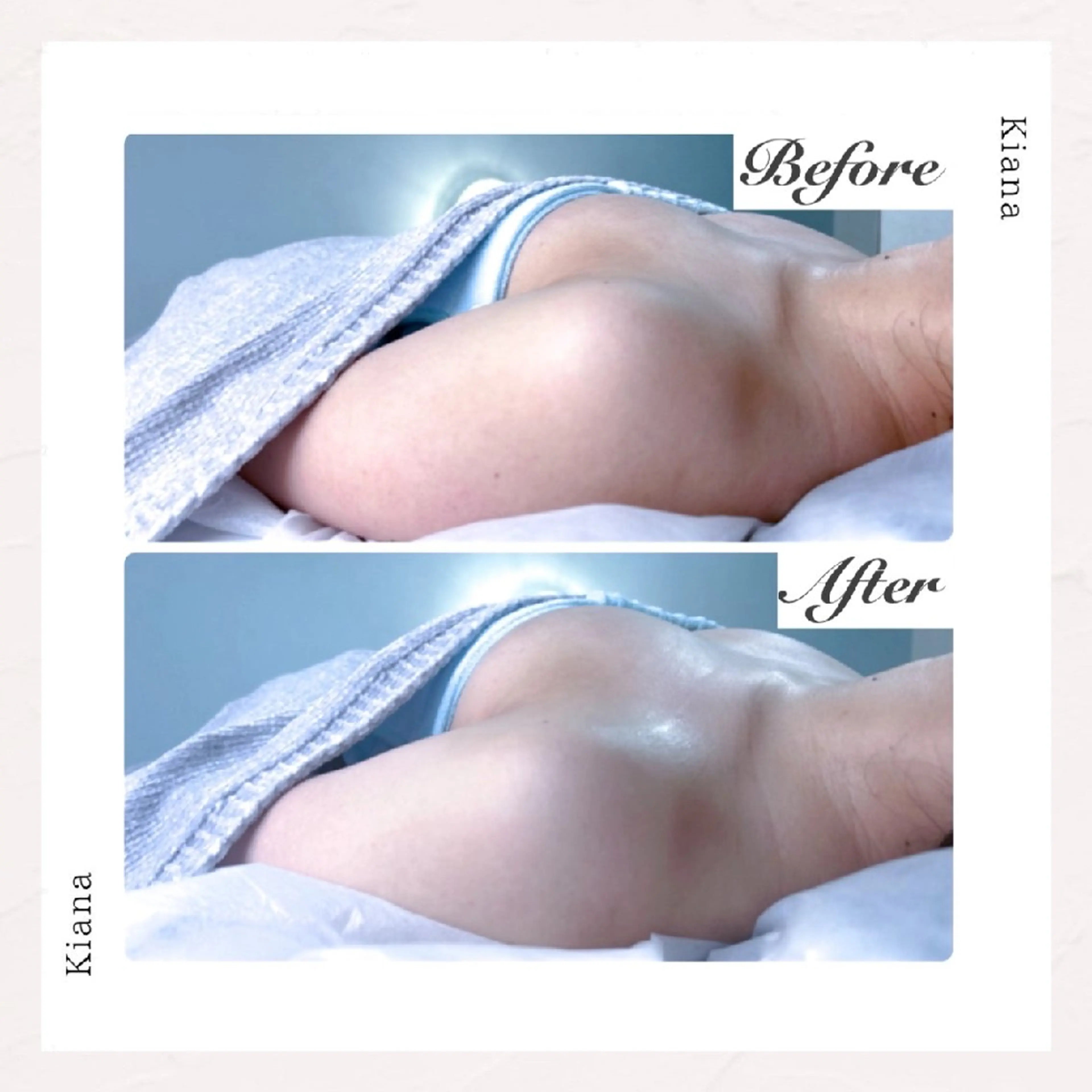 【バスト専門店 】 Kiana のエステ・リラクイメージ