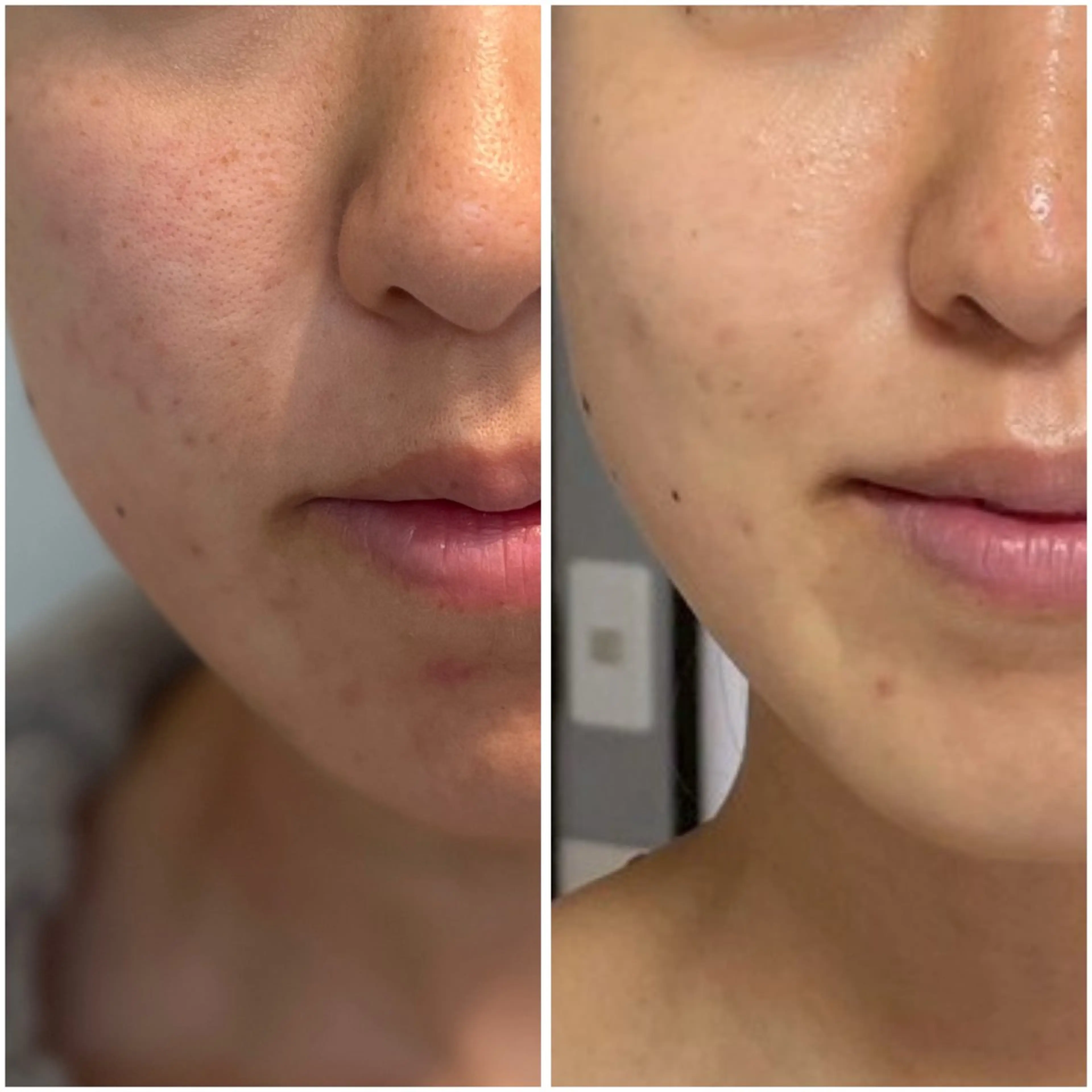 藤田 瑠夏のその他イメージ