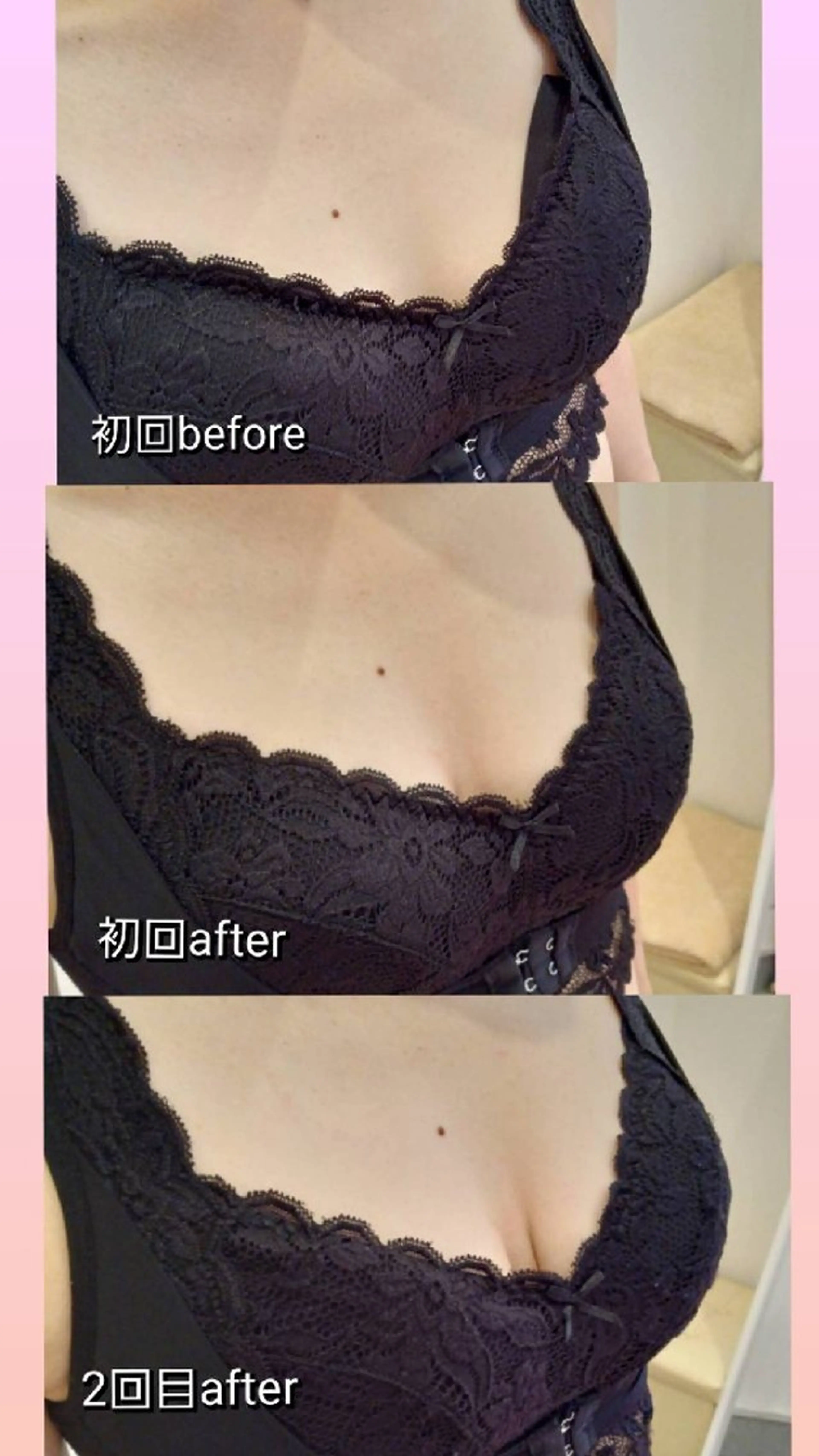 エステ マシュマロバスト coucouのエステ・リラクイメージ