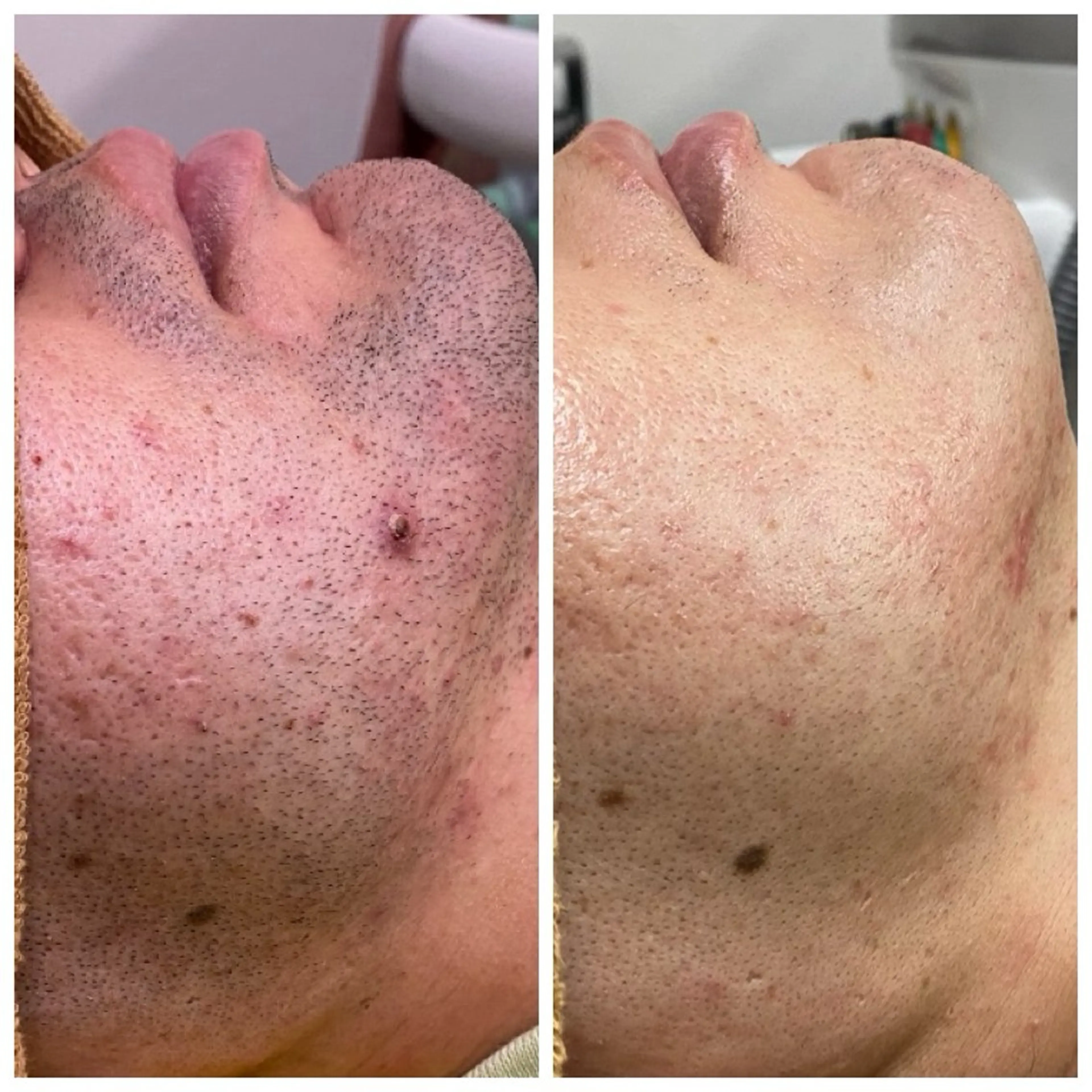 メンズ ヘアーサロンいしざわ所属・いしざわ /メンズ脱毛サロンのエステ・リラクイメージ