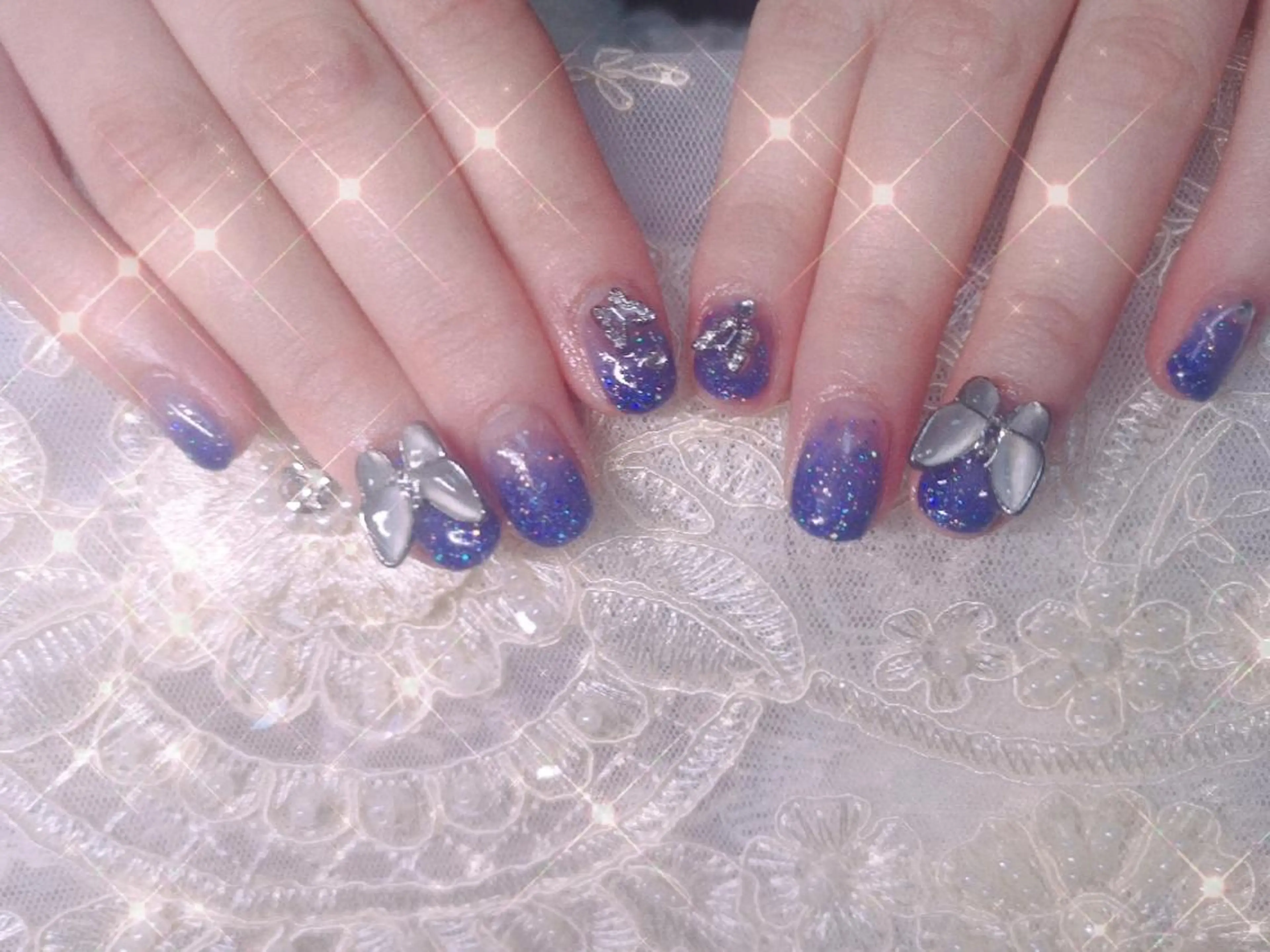 ショート ネイル ネイリストゆか💅 長さだし、深爪矯正のネイルデザイン