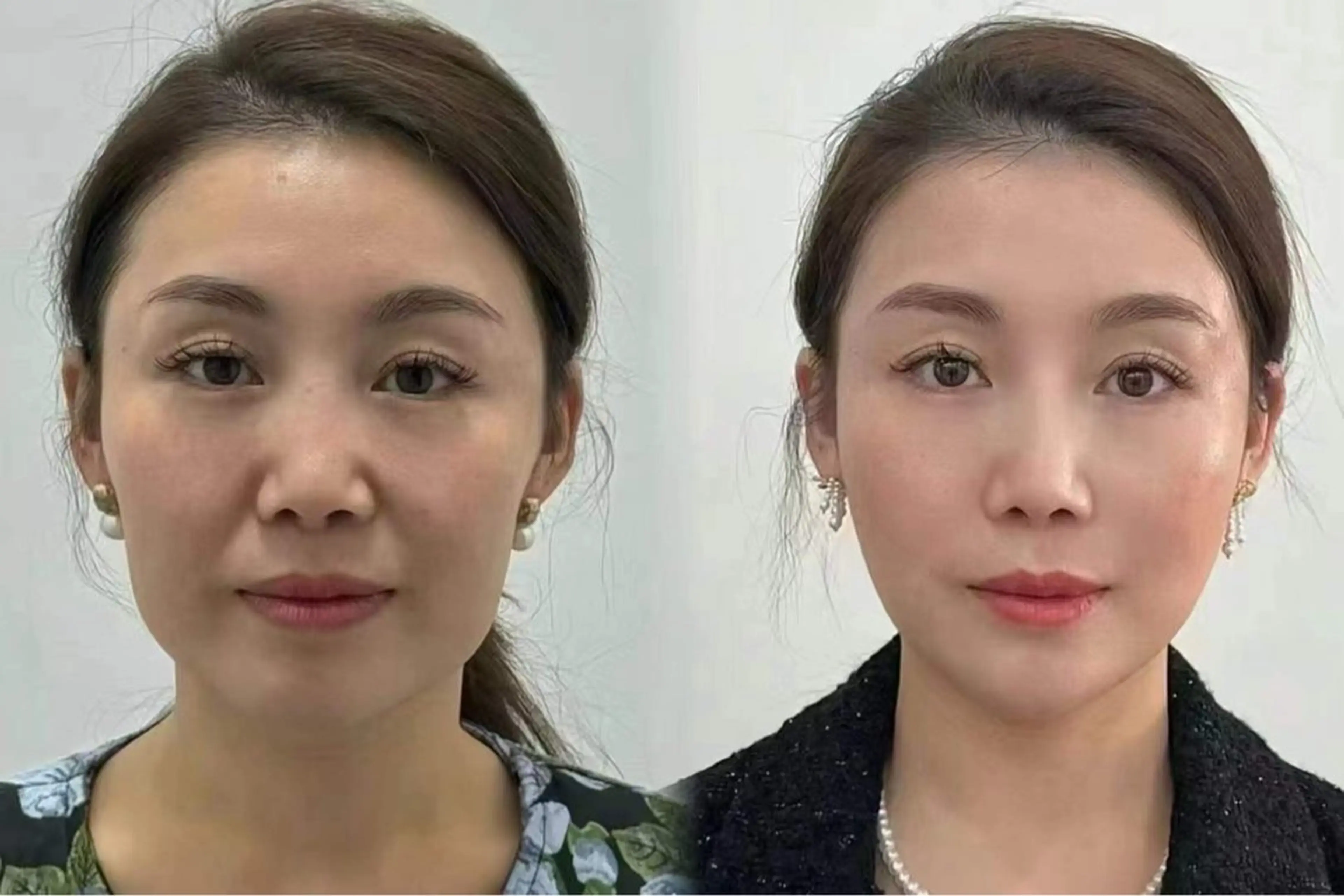 ネイル ブライダルネイル ホワイト エステ aliaハイフ&水光ジェットサロン所属・aliaハーブ水光店 エステティシャン募集のエステ・リラクイメージ