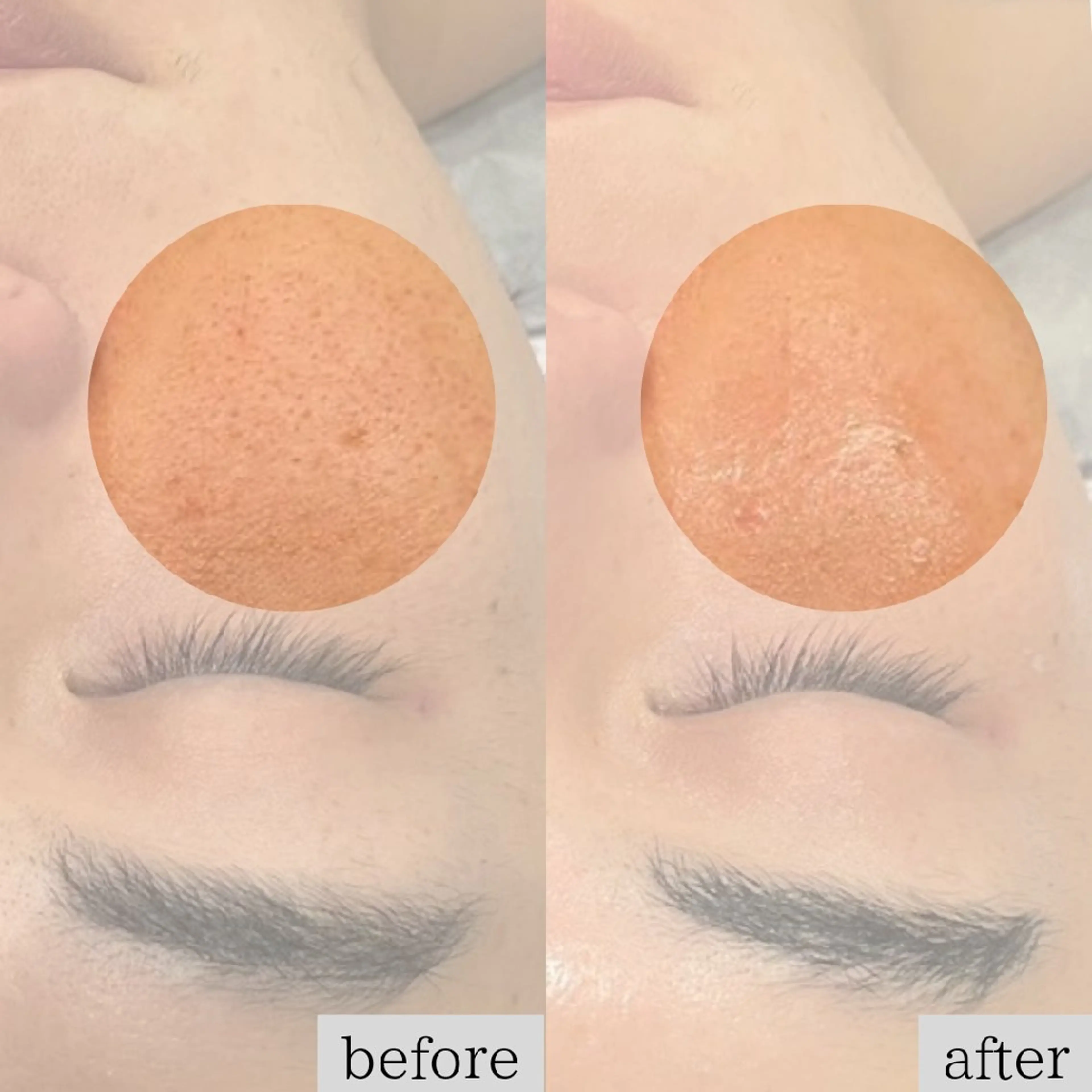 エステ DahliaBeauty ダリアビューティー所属・DahliaBeau tyフェイシャル中村のエステ・リラクイメージ