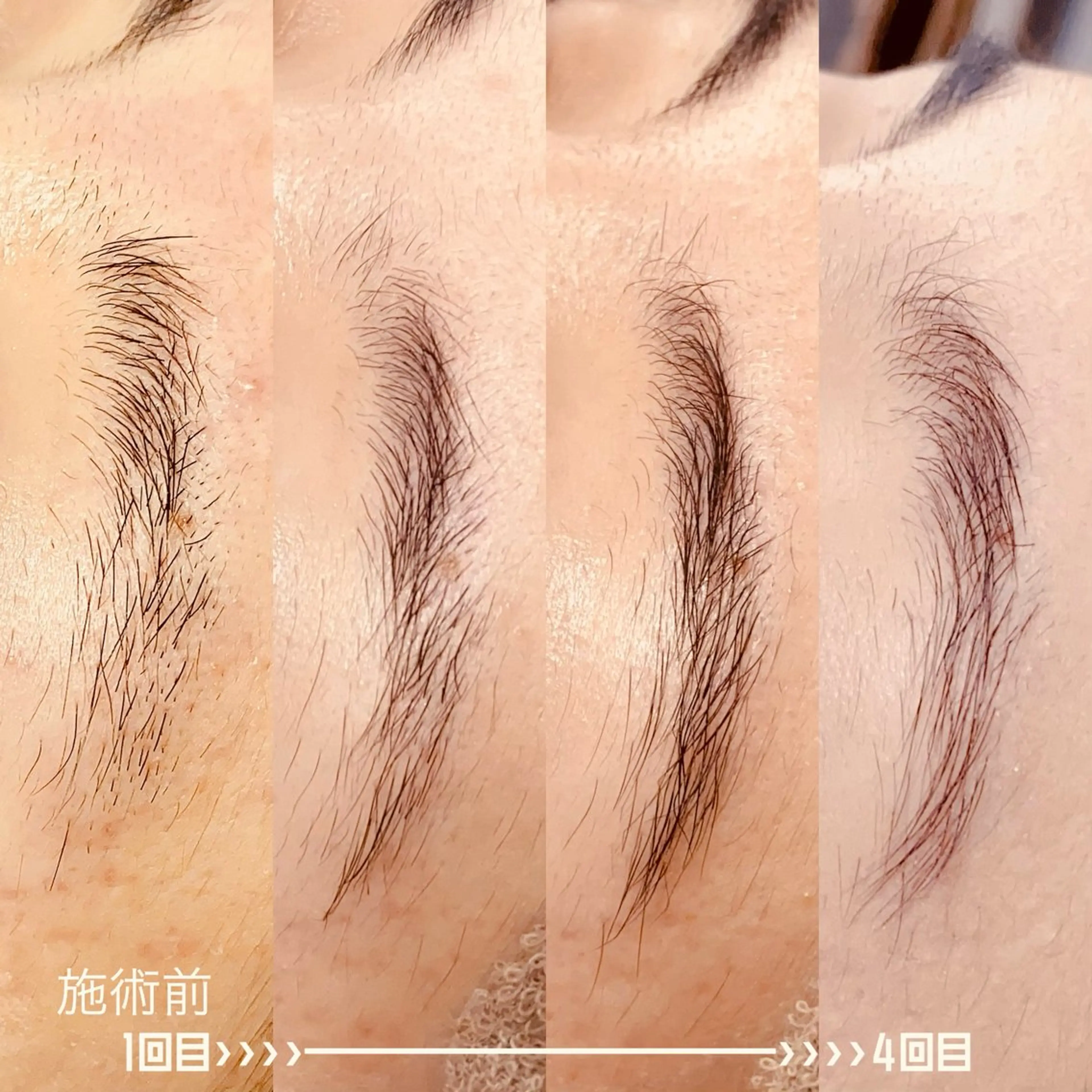 アイブロウ ワックス脱毛 その他(アイブロウ) cocorire インターパークの眉毛・アイブロウイメージ