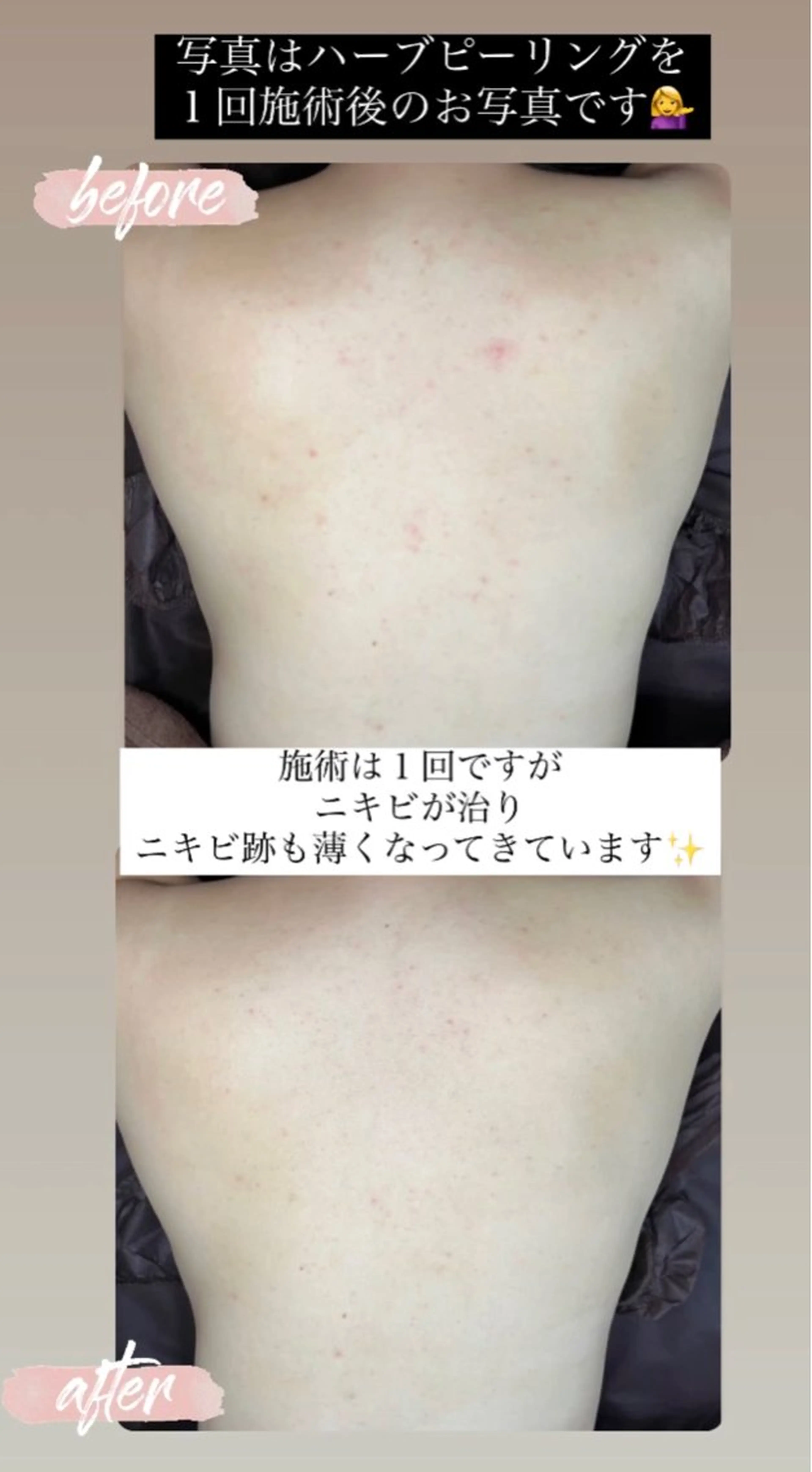 エステ ベラージュ【美背中・ 美尻・フェイシャル】のエステ・リラクイメージ