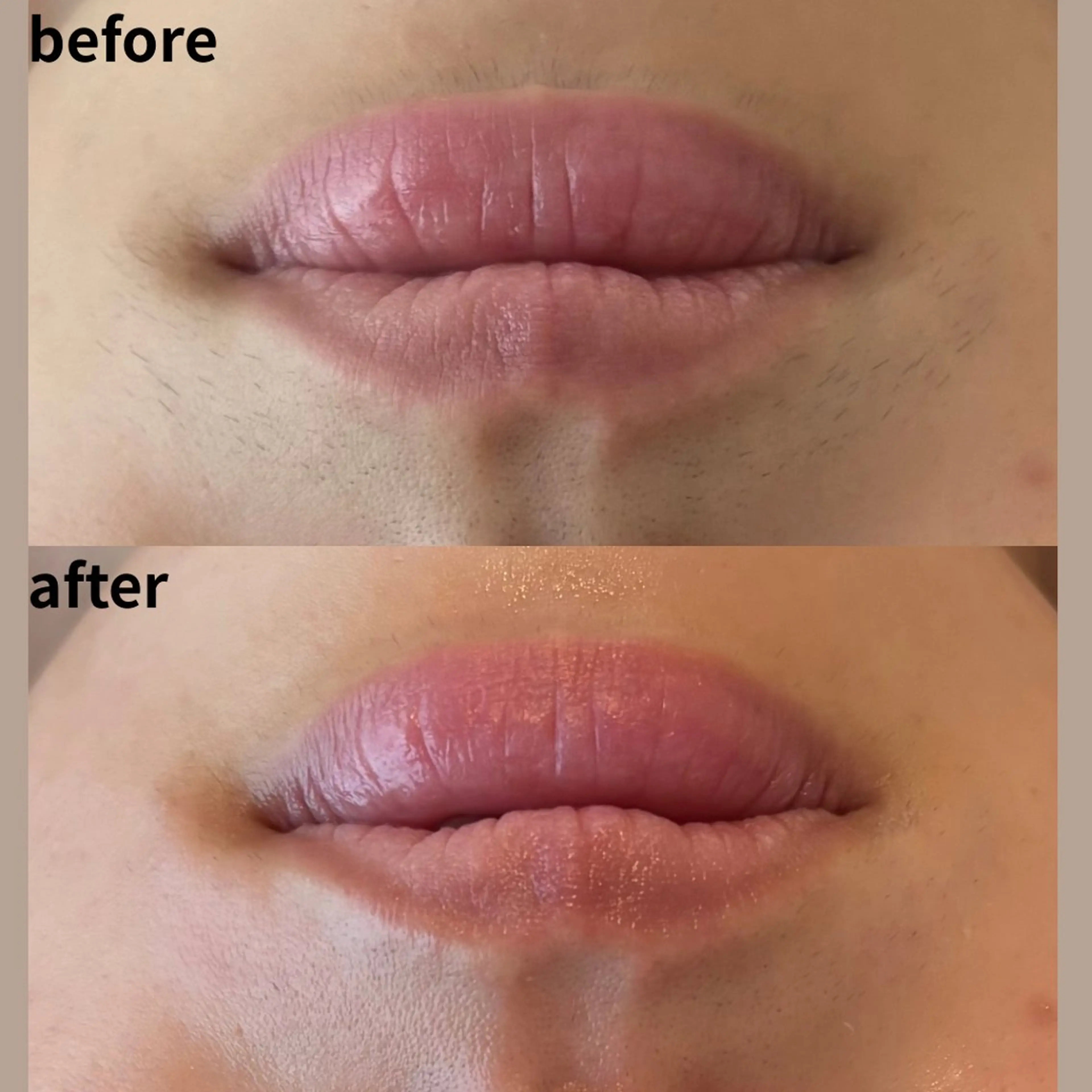 【モニター募集】フェイスワックス　ヒト幹細胞高保湿パック付きの写真