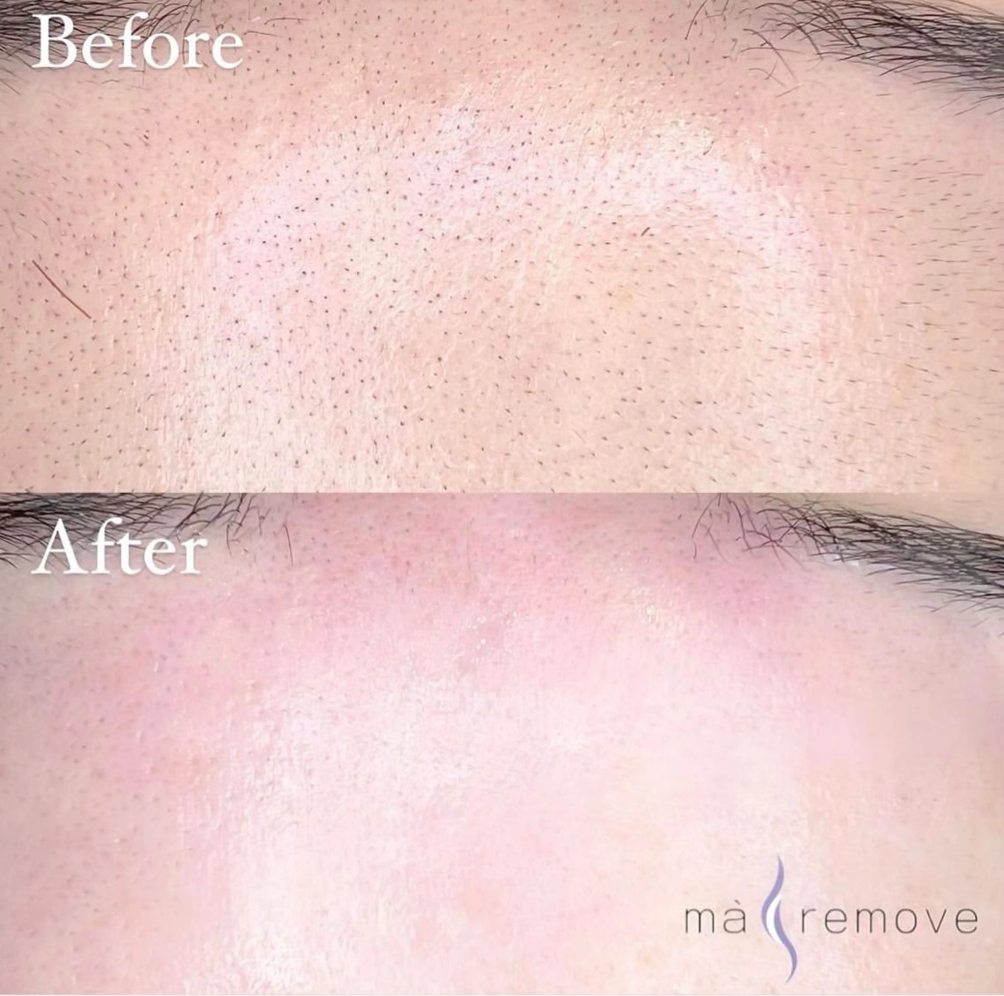 kondo runaのマツエク・マツパデザイン