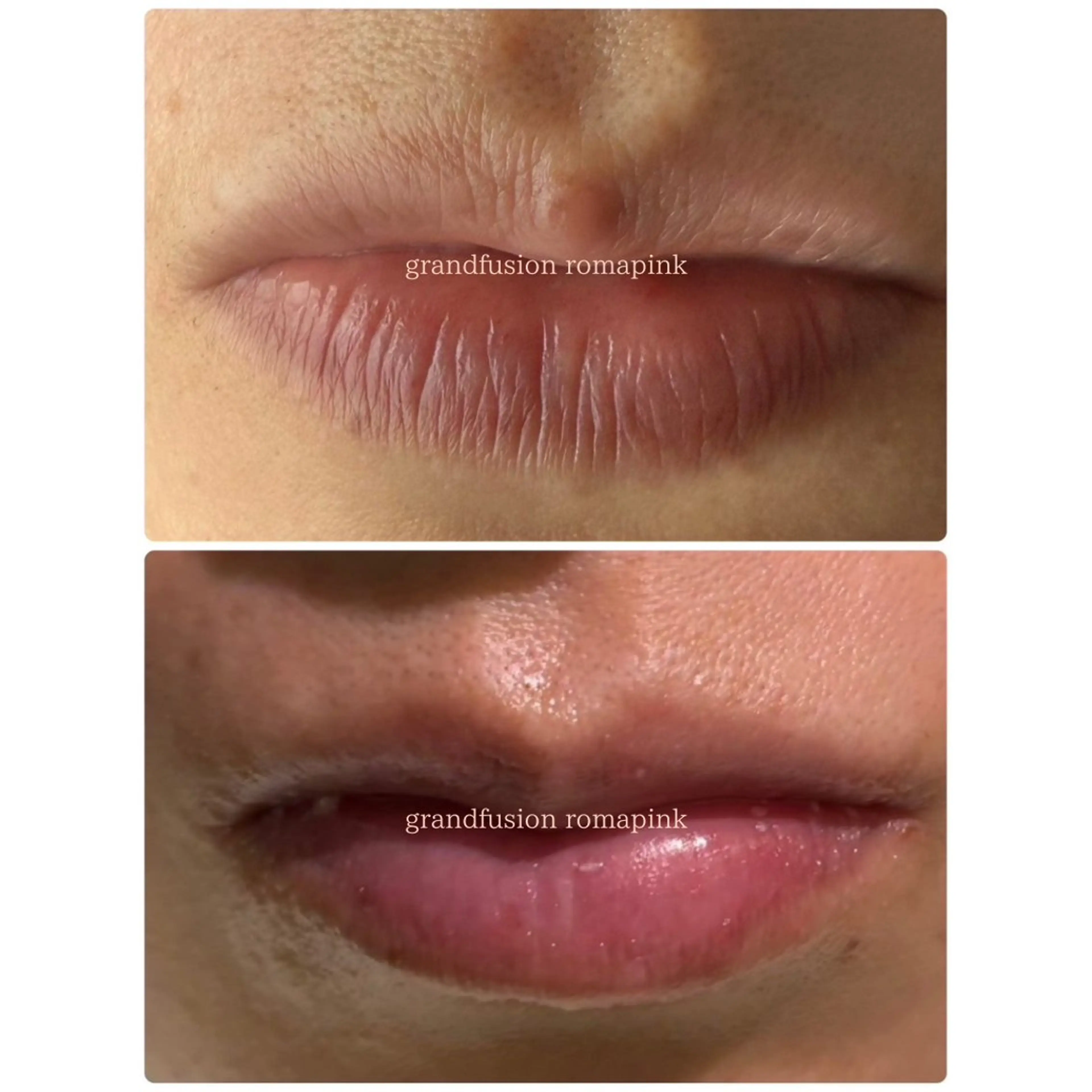 エステ Richeri 代官山のエステ・リラクイメージ