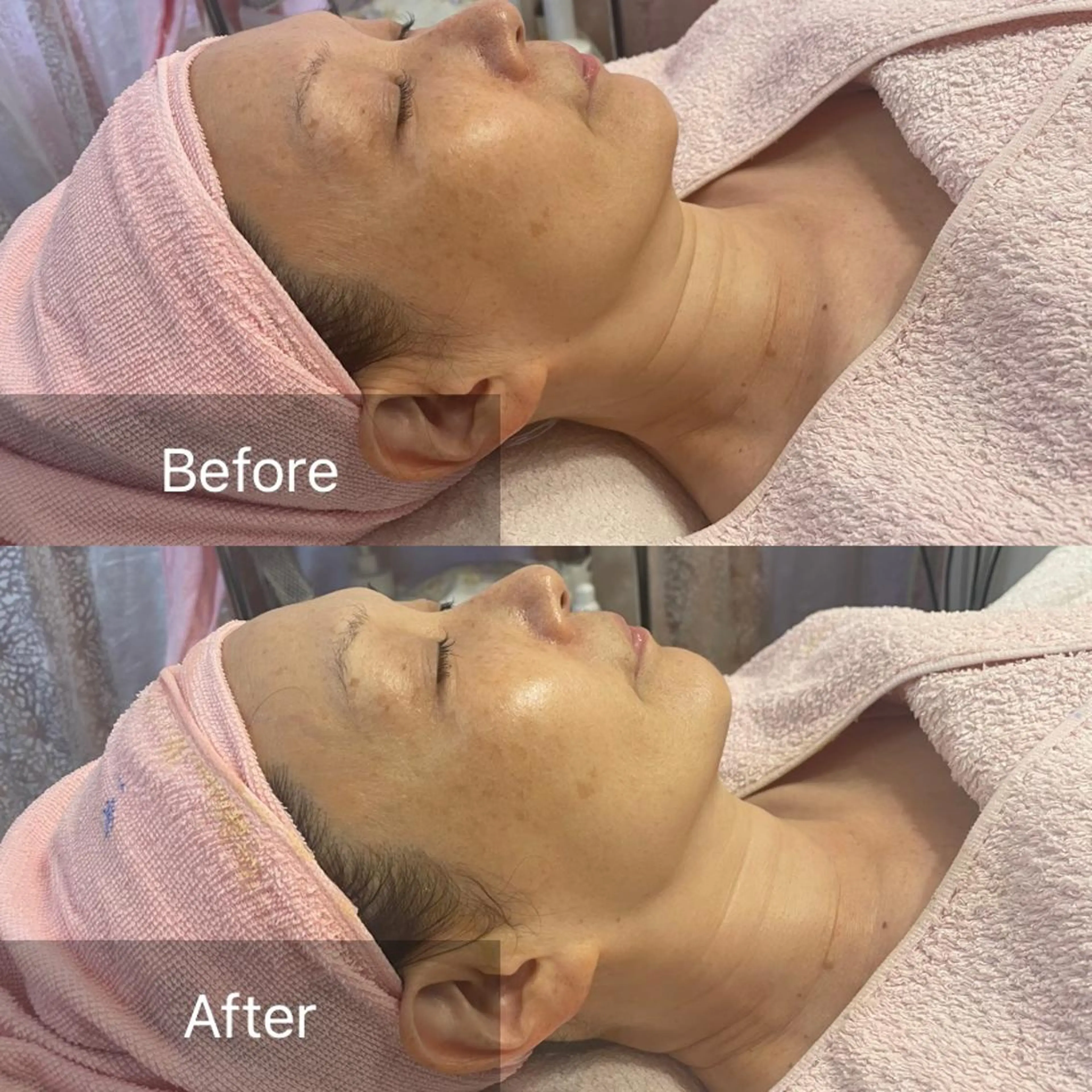 Lis Roseフェイシャルサロン所属・Lis Rose🥀 フェイシャルサロンのエステ・リラクイメージ