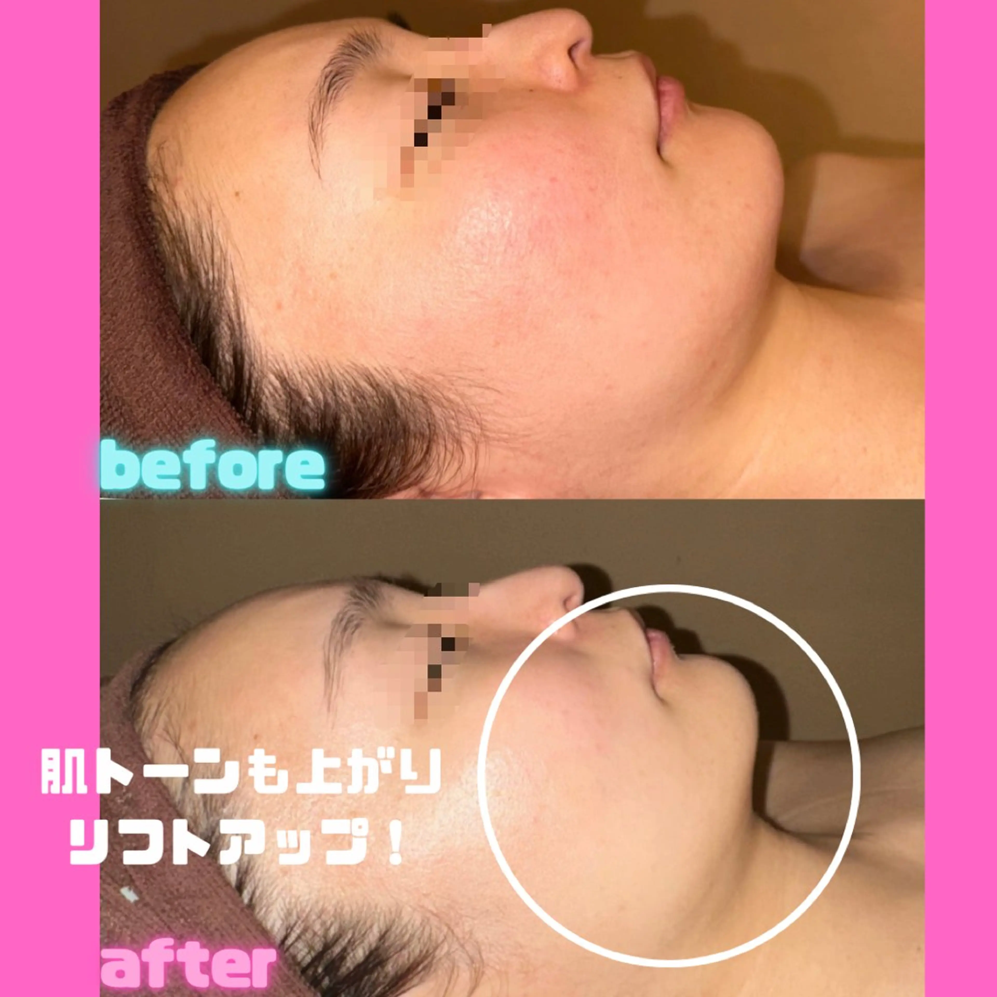 エステ 痩身&美肌サロン 堀米✨のその他イメージ