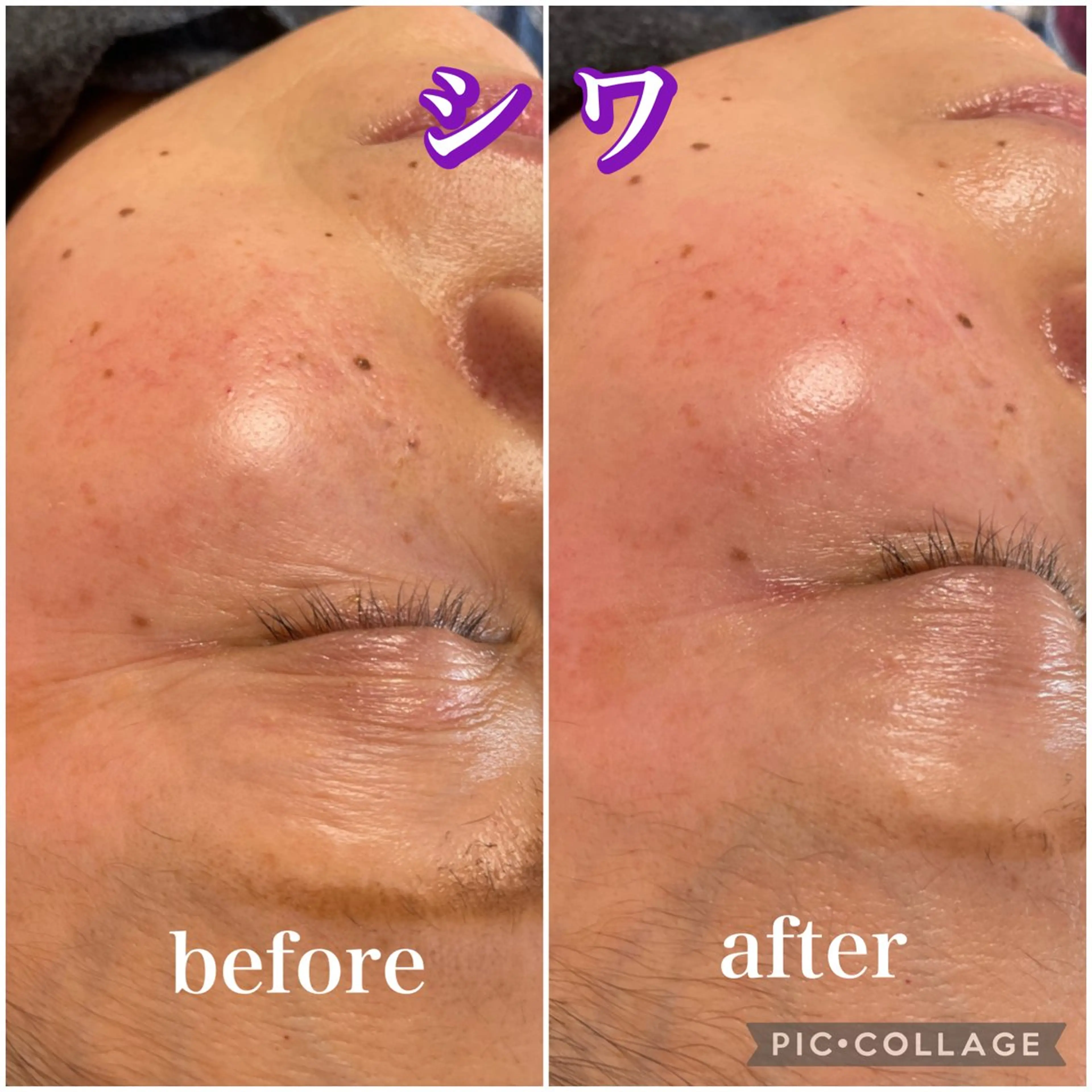 毛穴レス ハーブ＆ ワックス脱毛×光脱毛のエステ・リラクイメージ