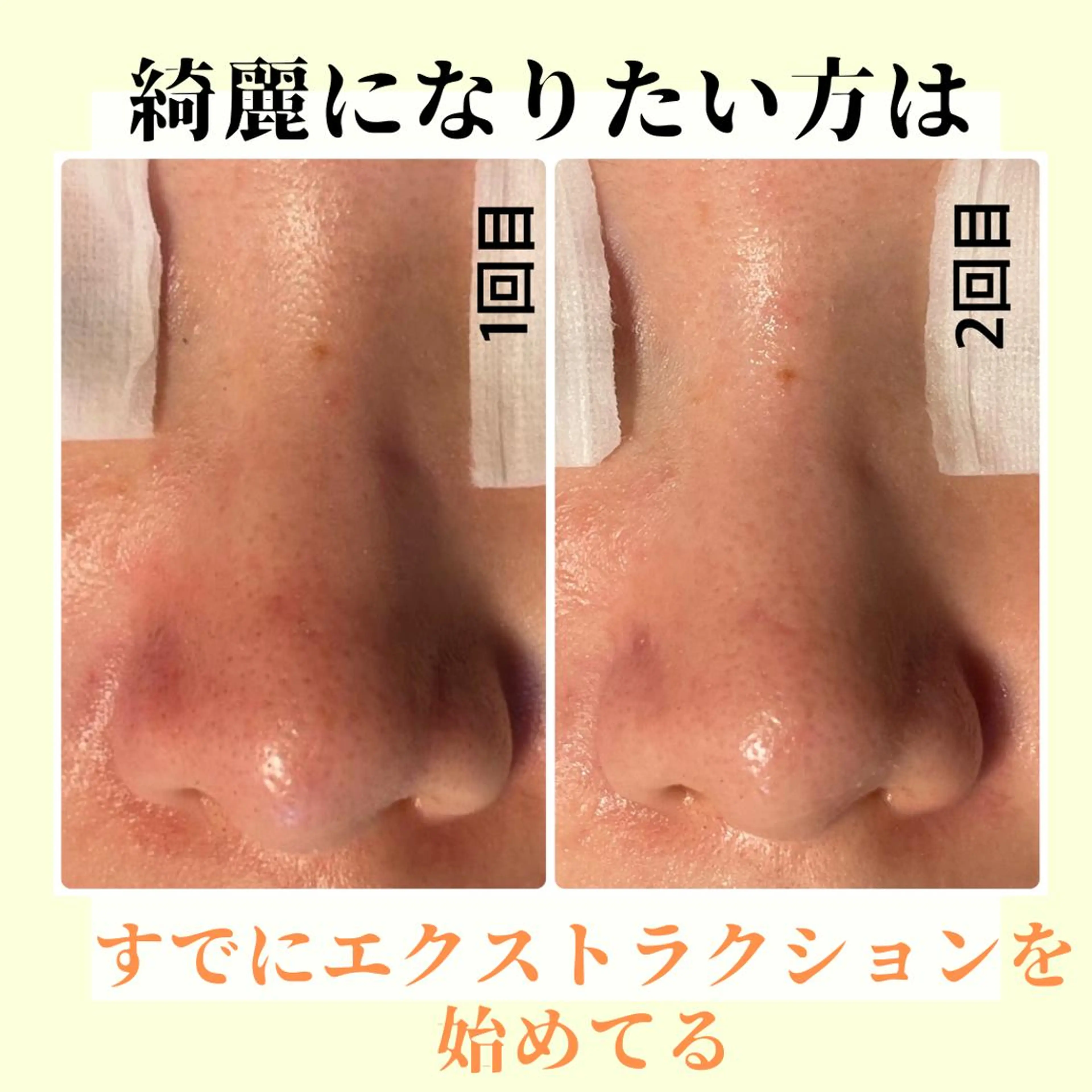 ピーリング専門店 Belluteのエステ・リラクイメージ