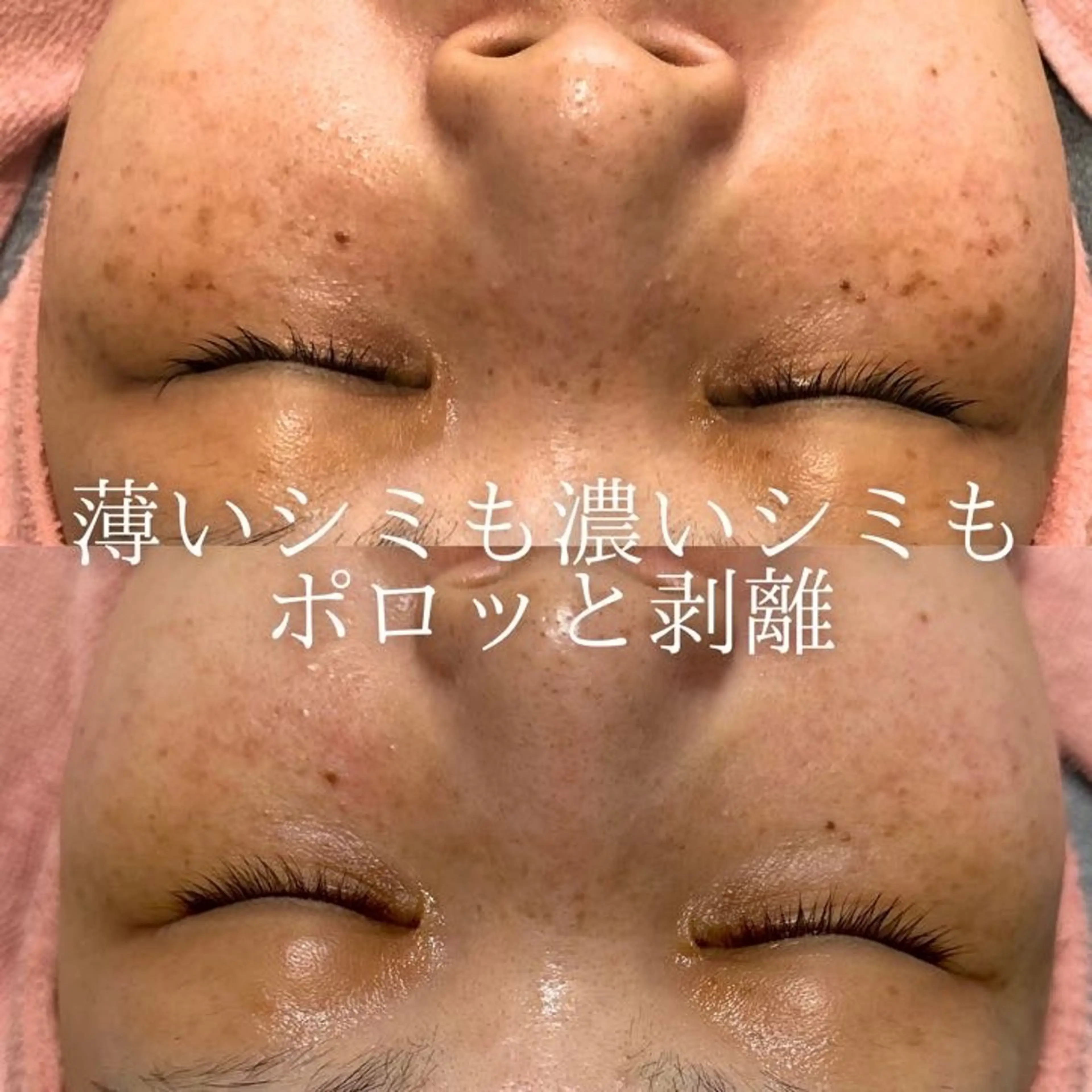 エステ 肌質改善サロン BestBelleのエステ・リラクイメージ