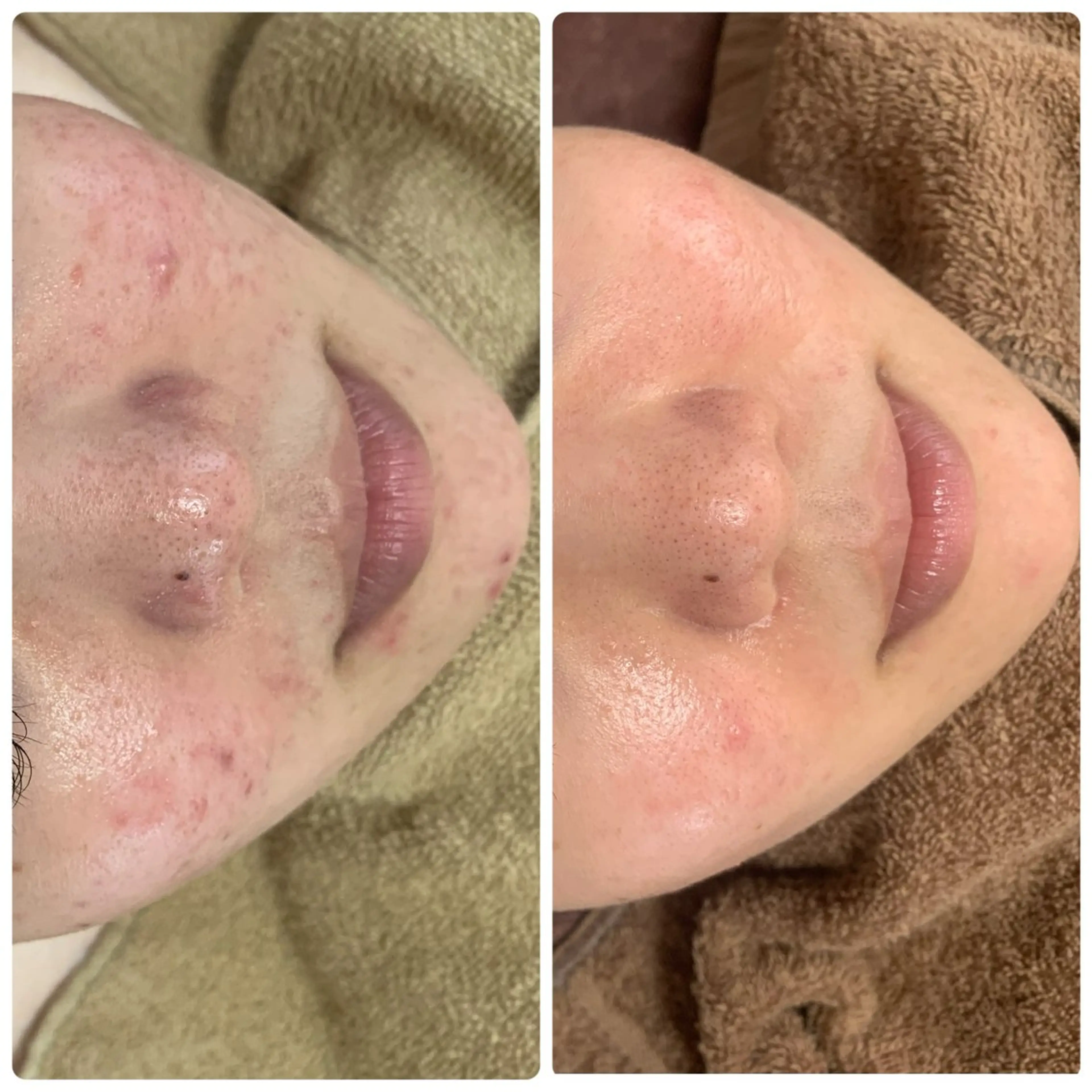 beautysalon  LINO所属・平日昼間限定★ 全メニュ¥6600のエステ・リラクイメージ