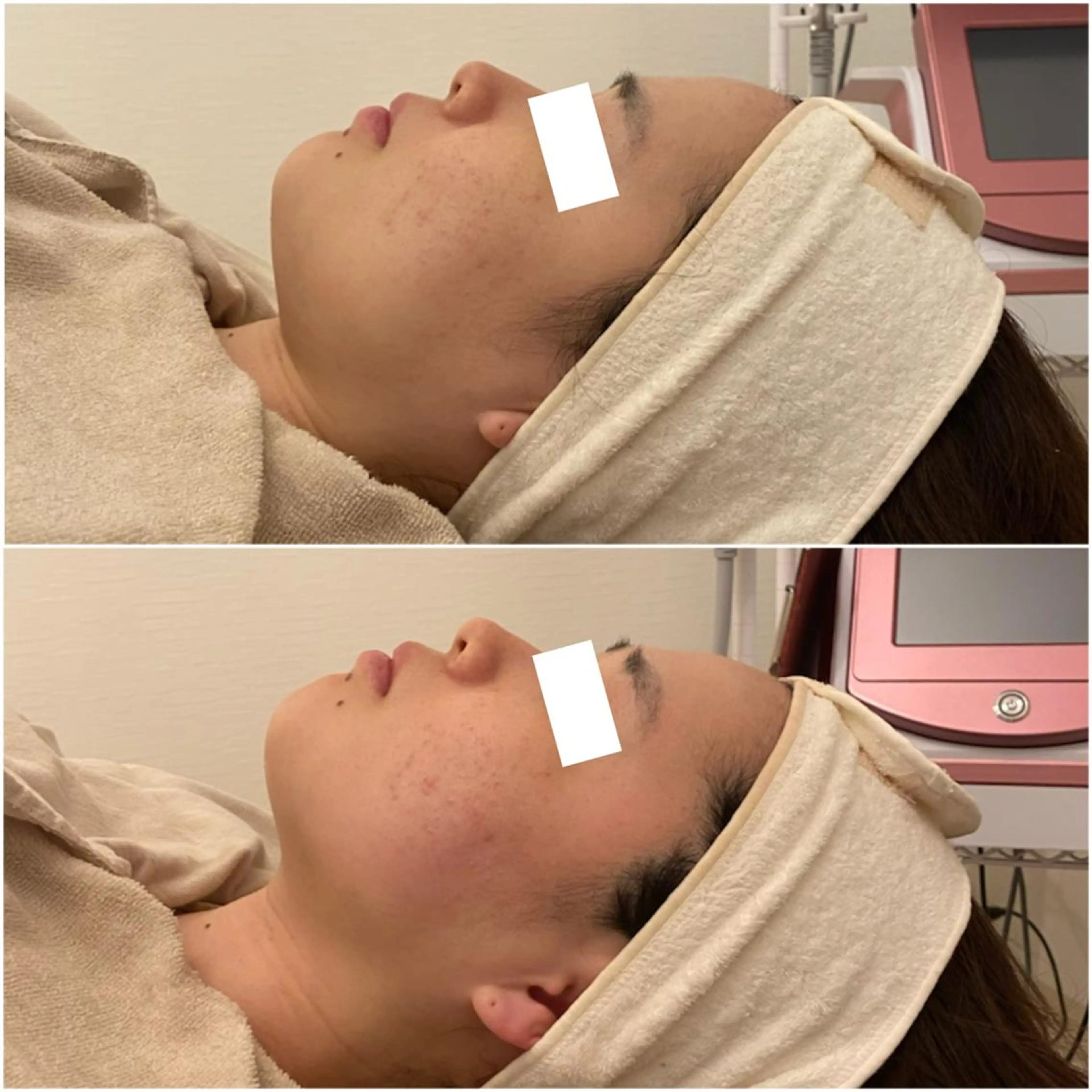 ✨美肌水光✨ アトリエリュバンのエステ・リラクイメージ