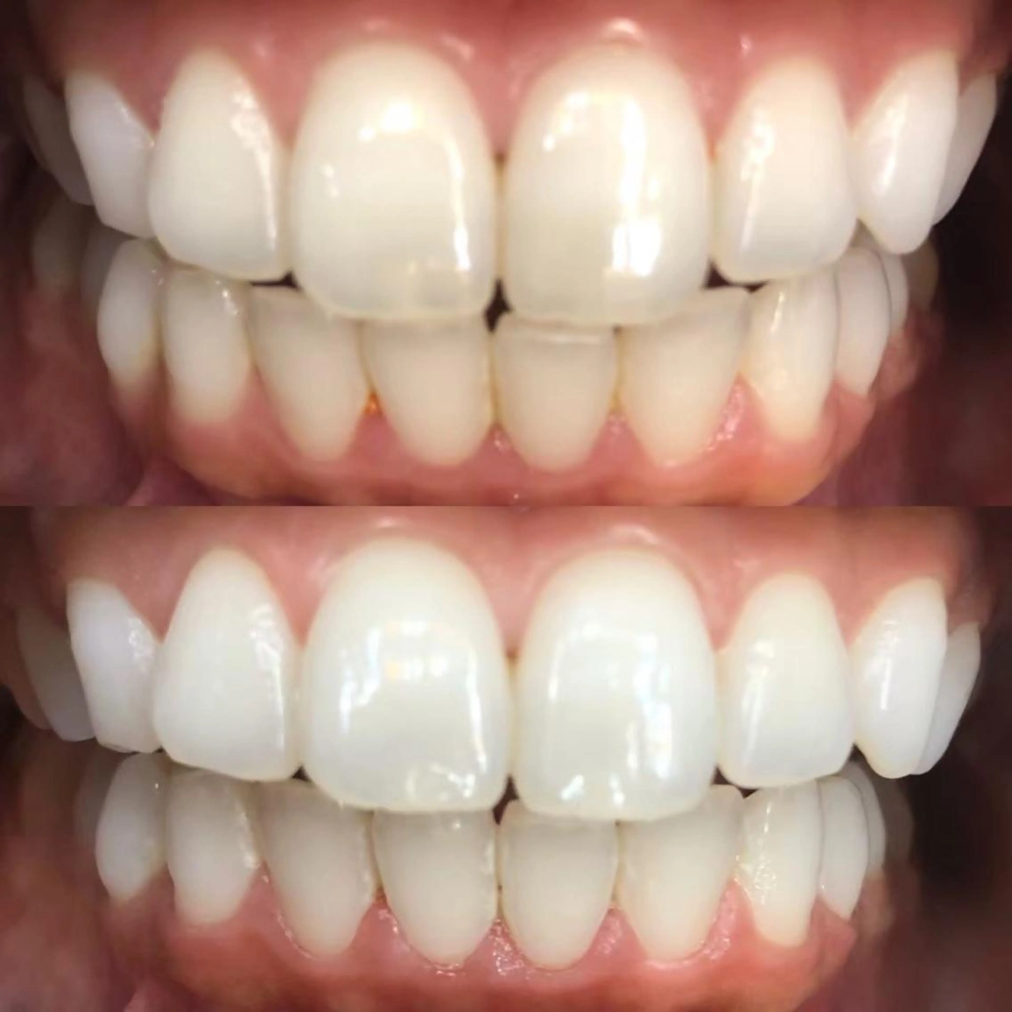 その他 LBSホワイトニング 🌐梅田店公式のその他イメージ