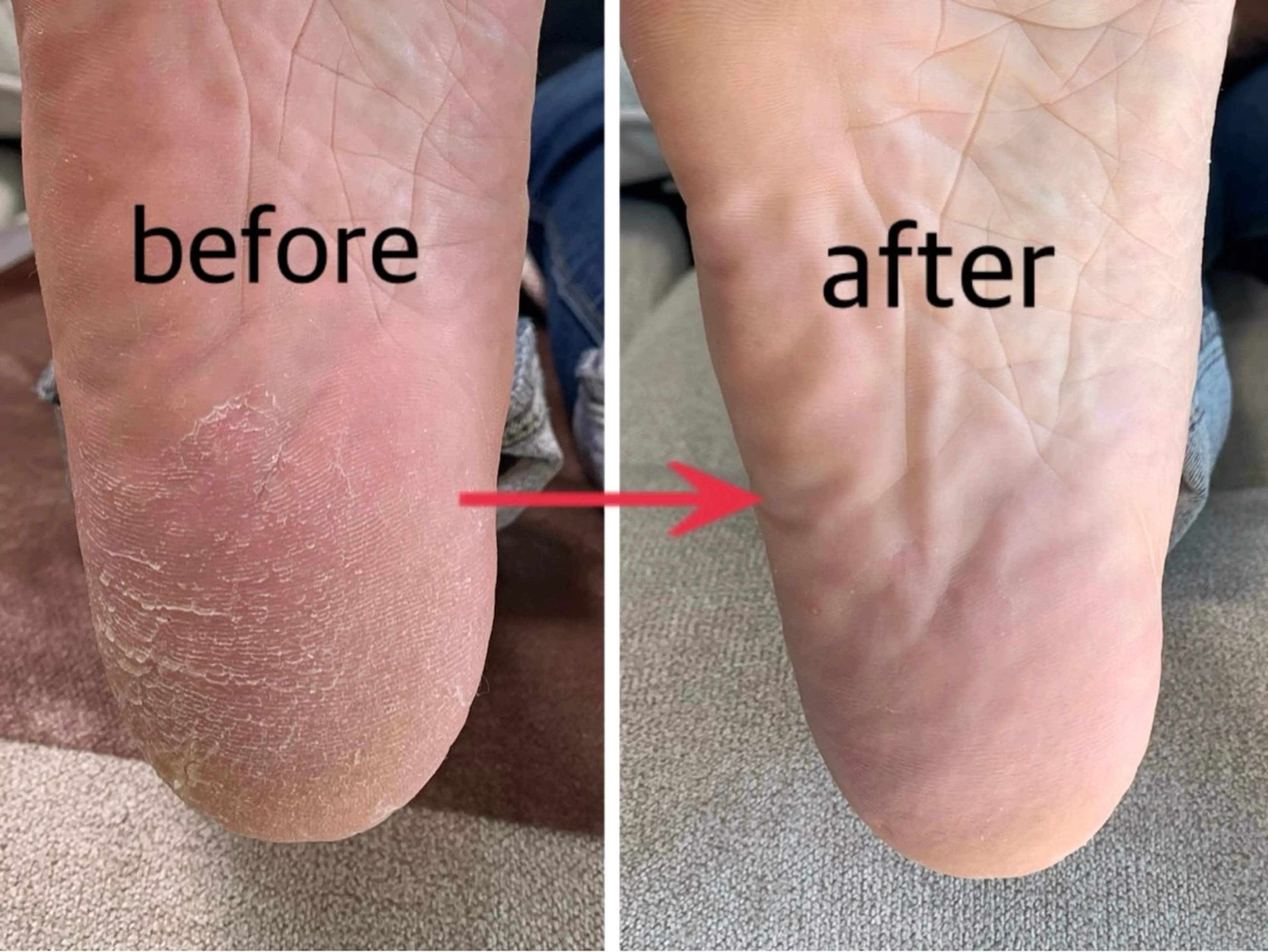 Achura エチュラのネイルデザイン