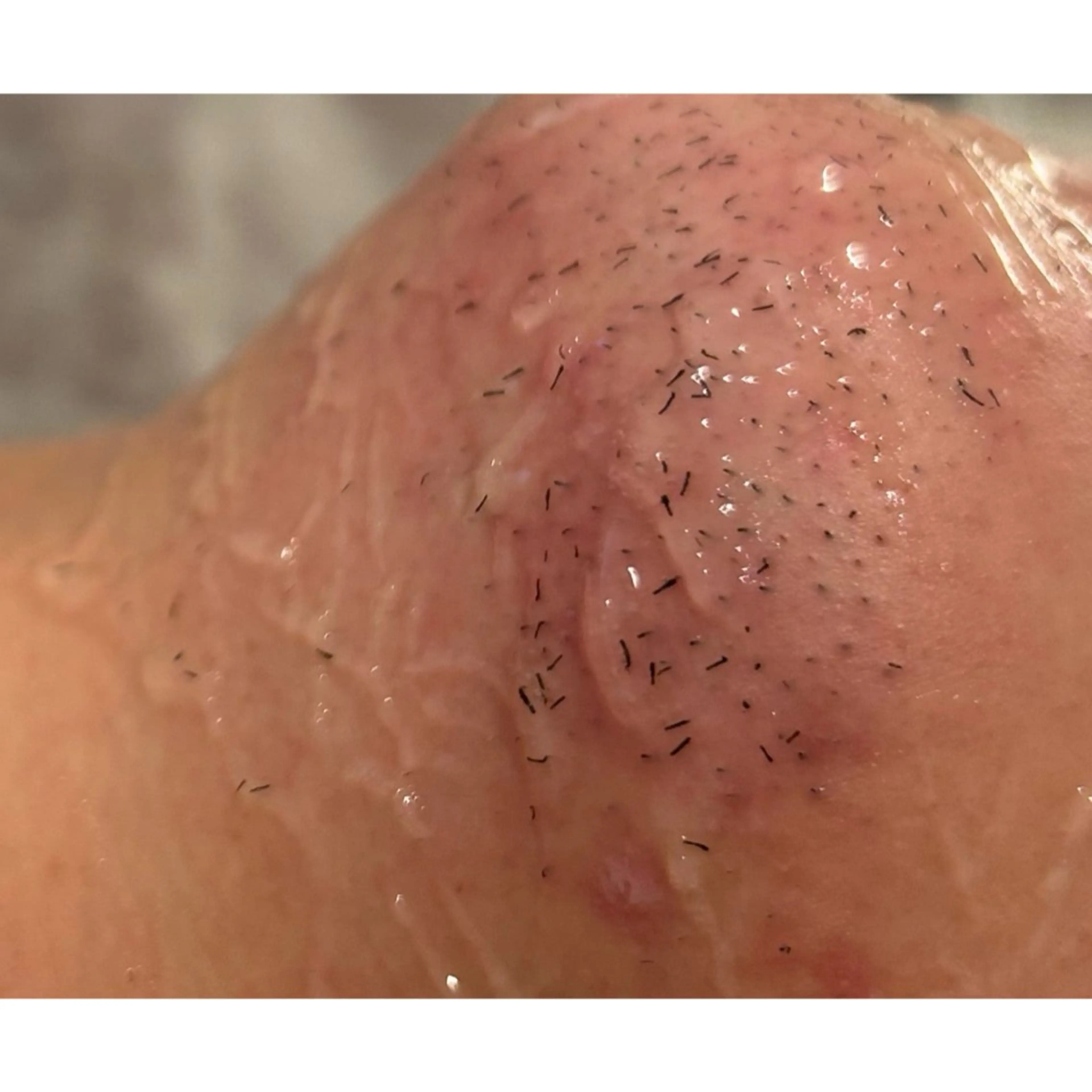 脱毛 脱毛専門サロンElixir加須店所属・脱毛専門サロン Elixir　加須店のエステ・リラクイメージ