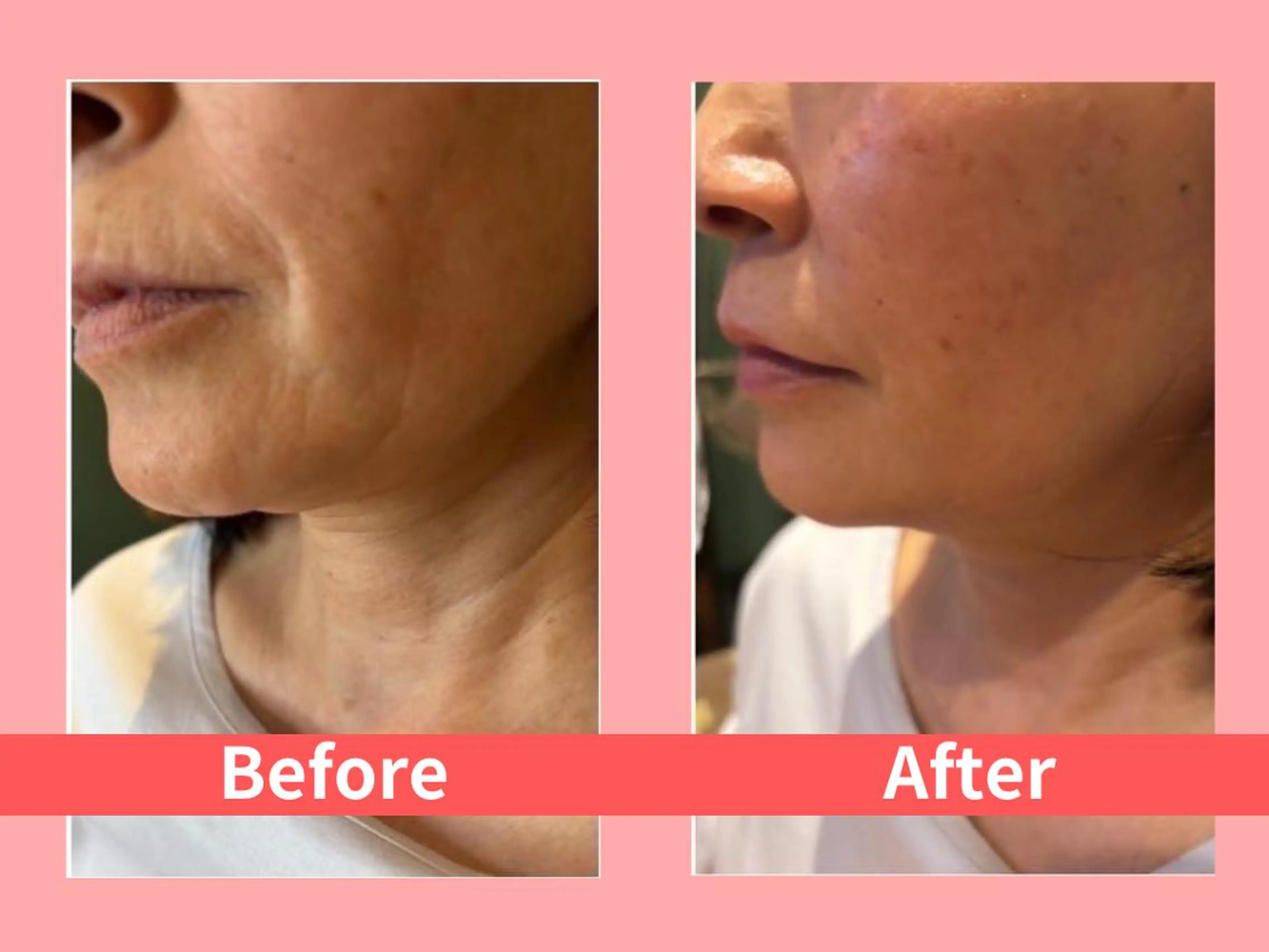 エステ リラク 痩身&小顔矯正専門店 Re:Livesのエステ・リラクイメージ