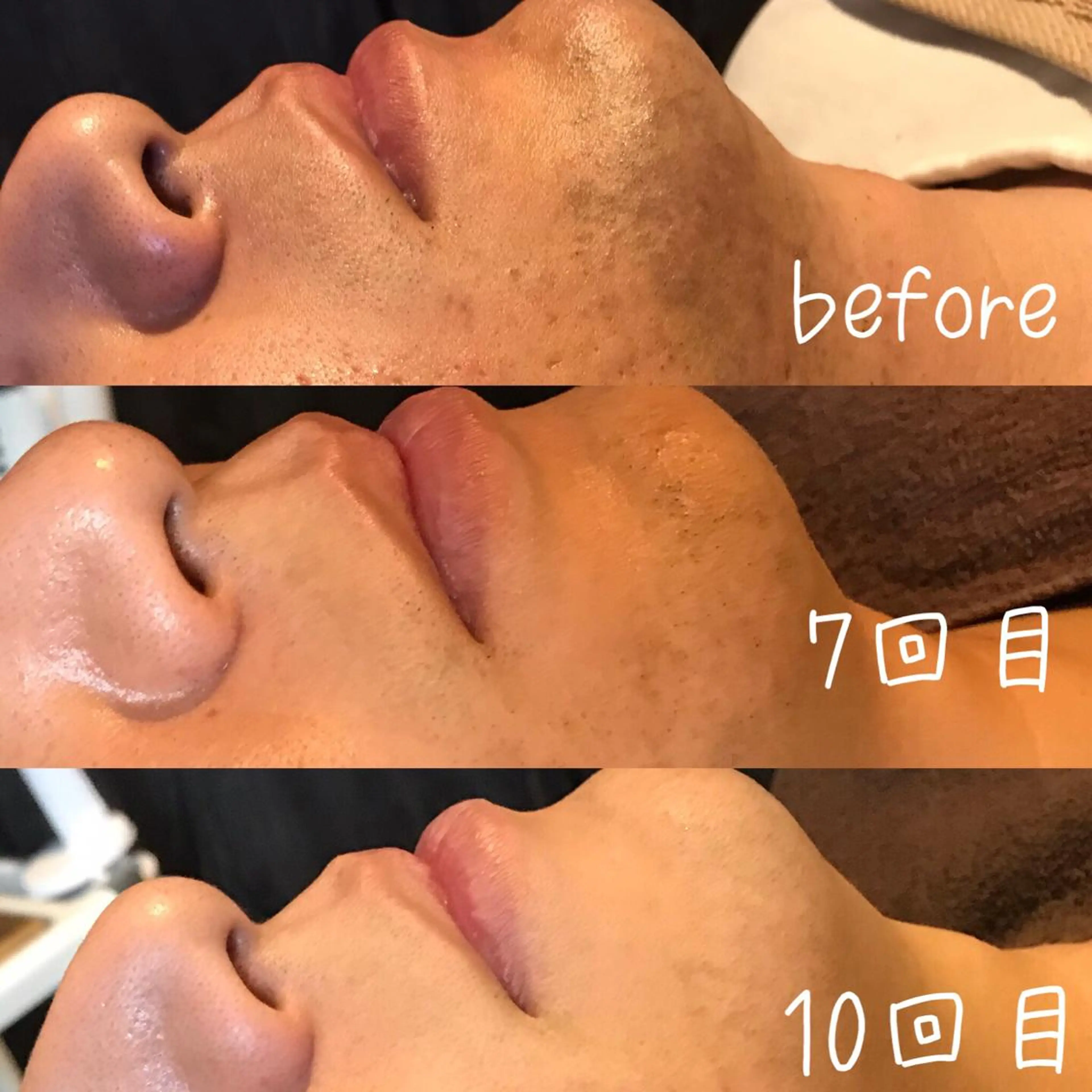 脱毛 浜野 恵美のエステ・リラクイメージ