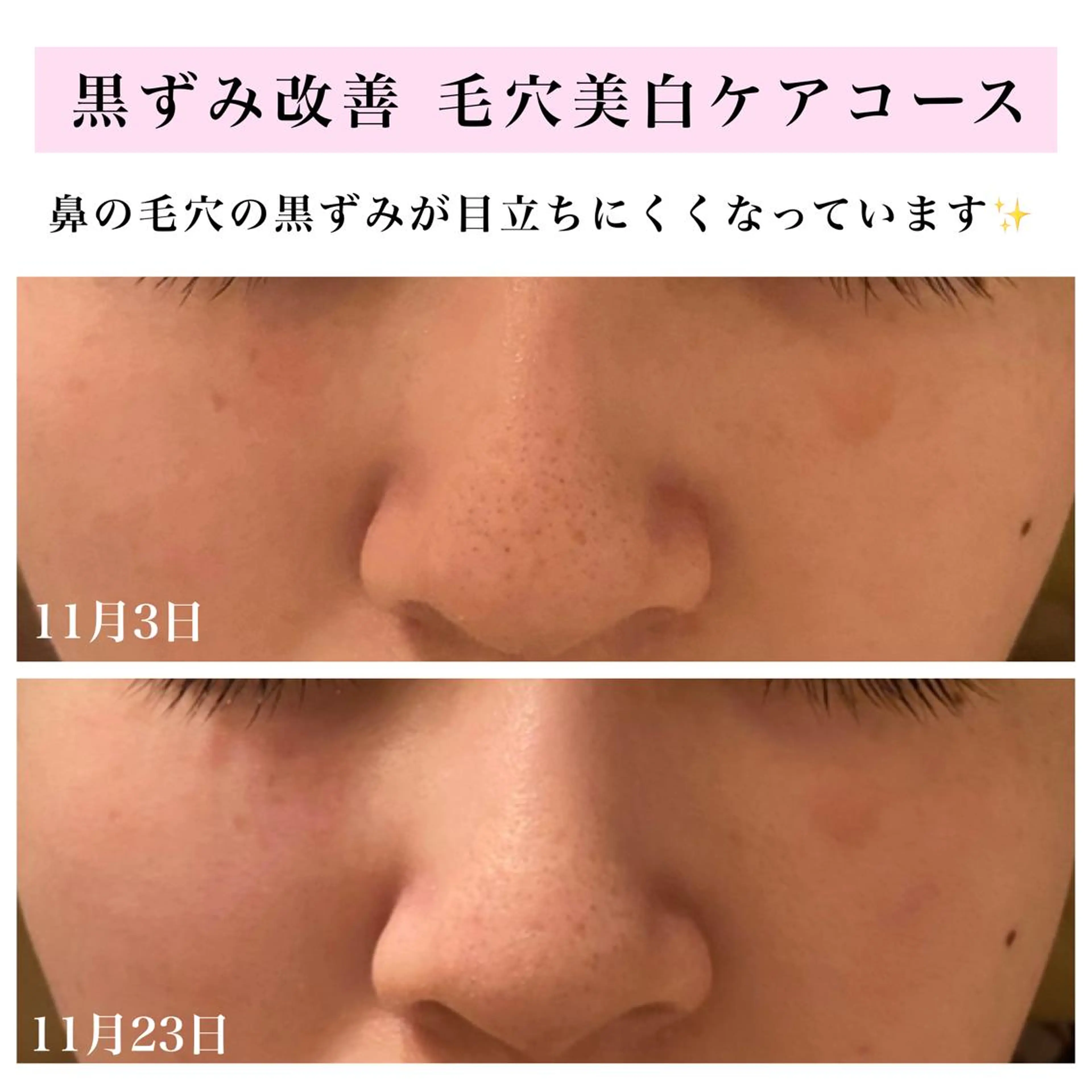 エステ リラク Bellesthe （ベルエステ）のエステ・リラクイメージ