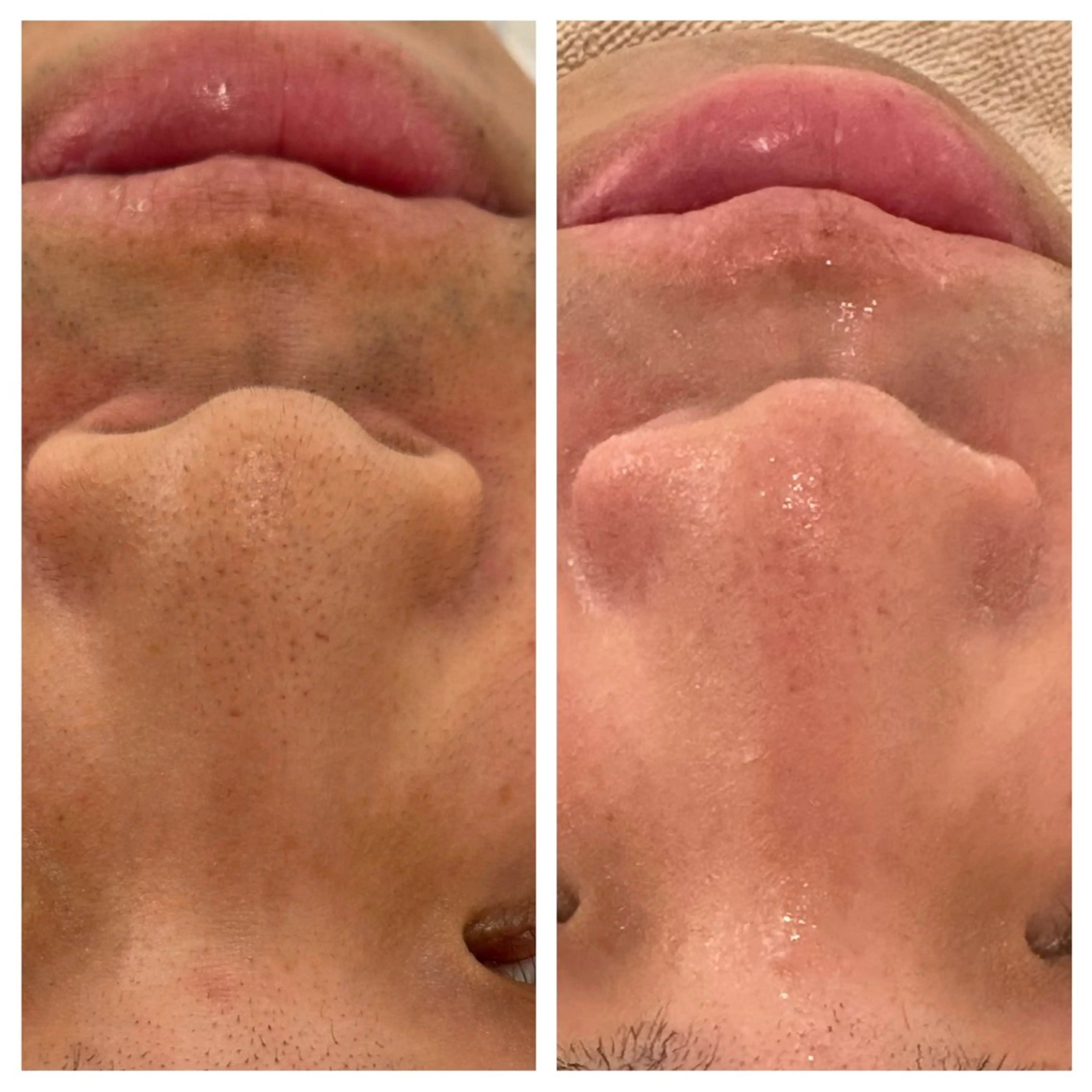 エステ リラク ANERA Second所属・尾上 沙織のエステ・リラクイメージ