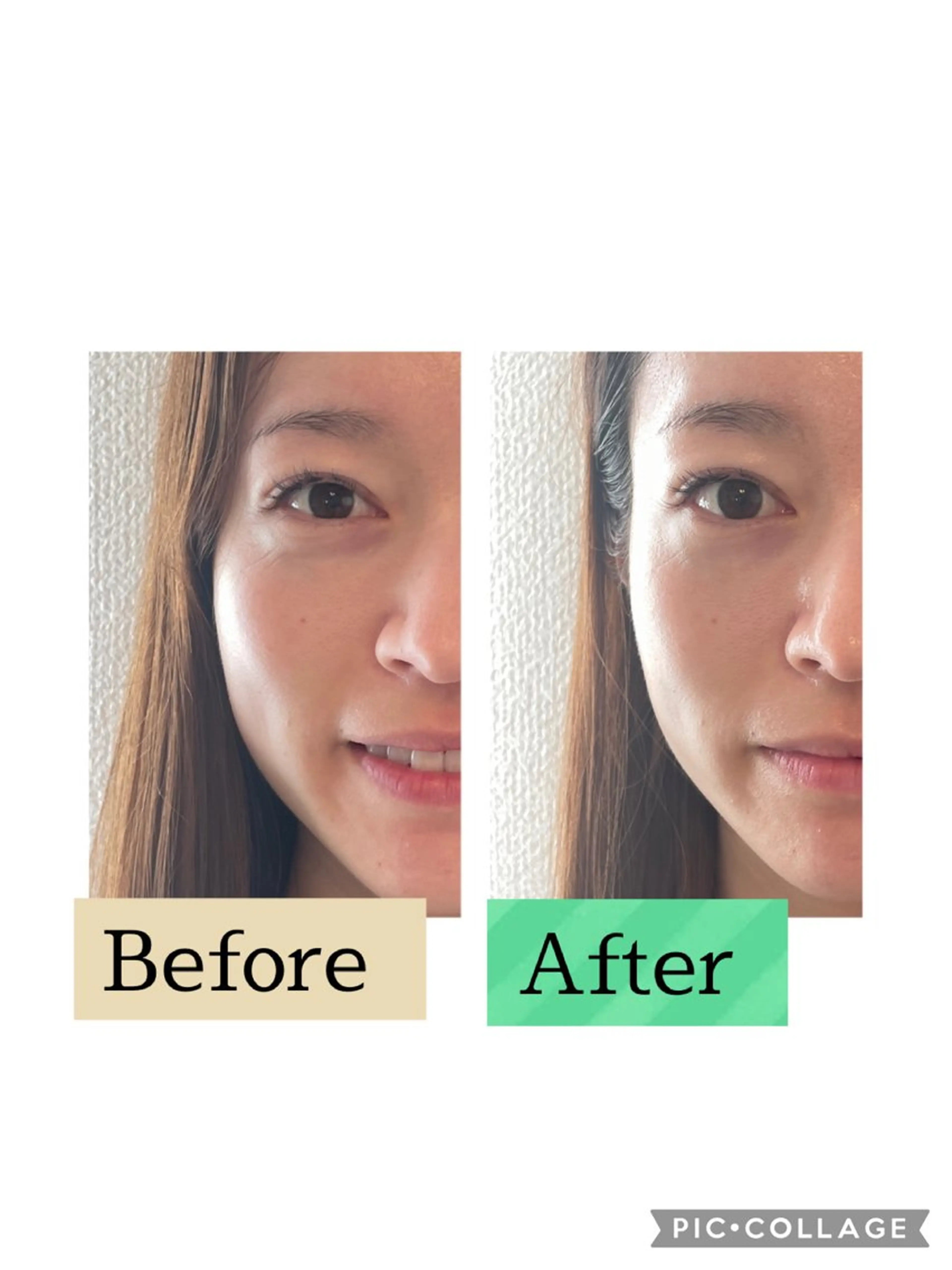 なでるだけでみるみる小顔💖美調整小顔矯正モニター１回価格3,500円通常価格12,000円の写真