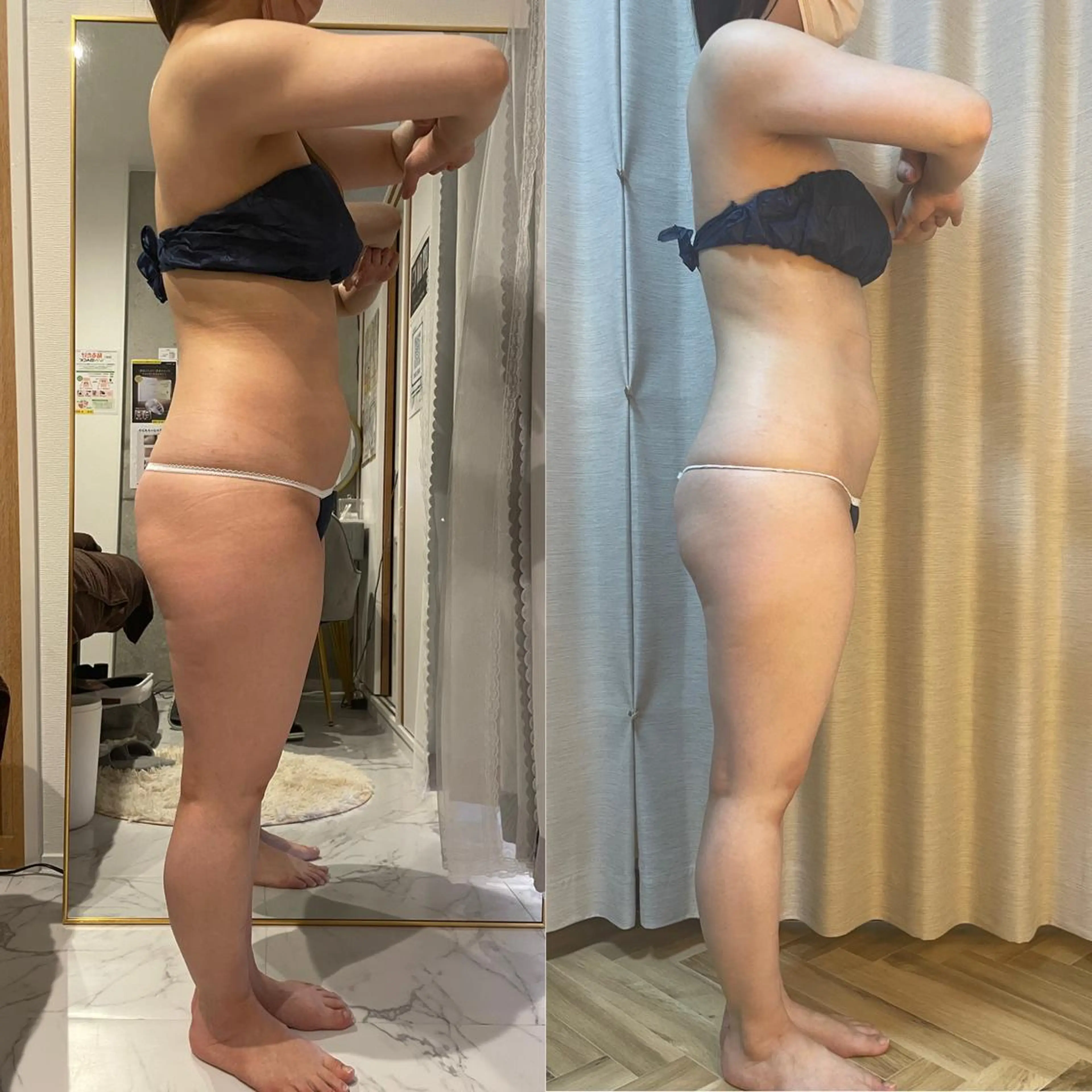 ウィンバックボディーコース　当日相談の写真