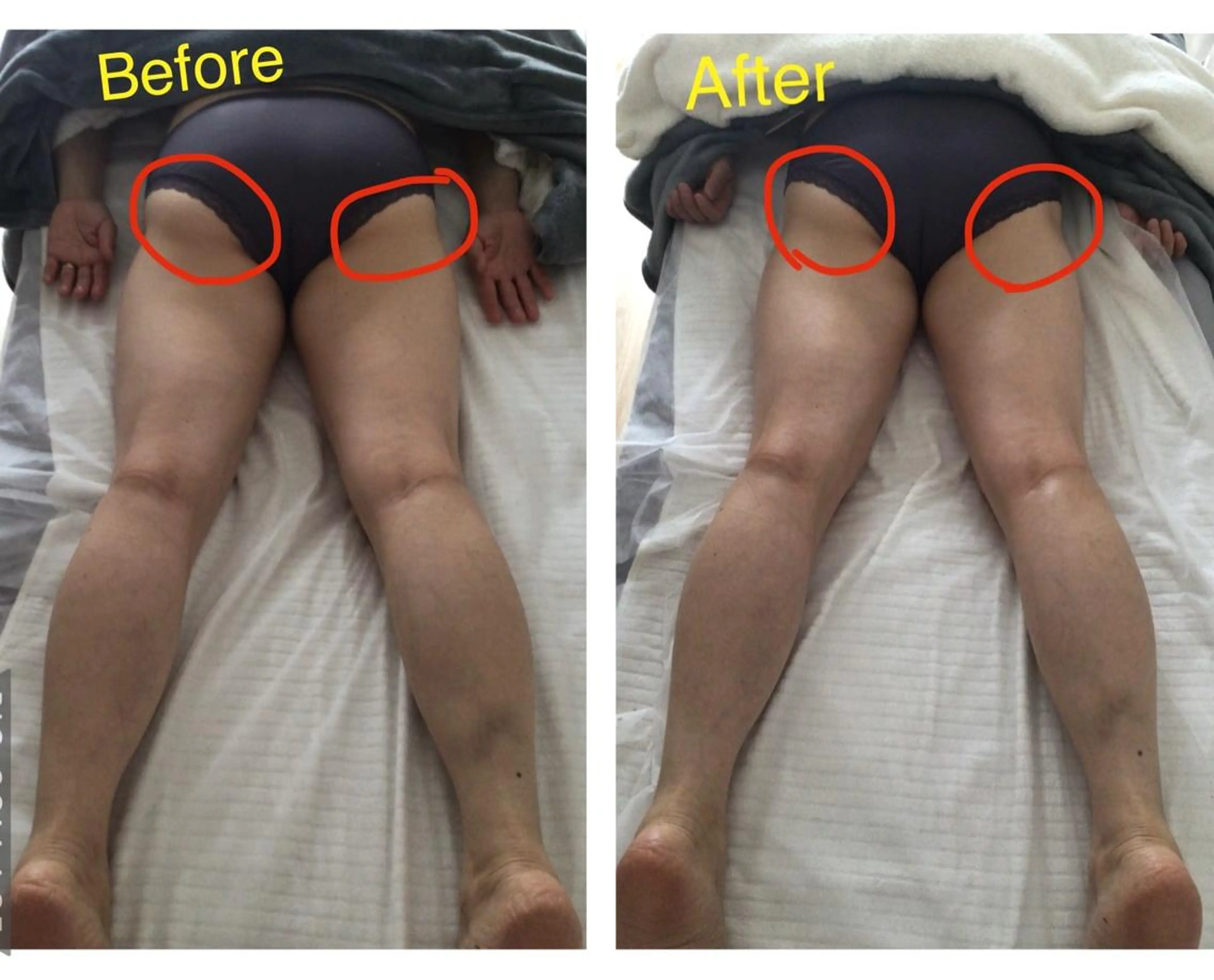 子宮矯正/腸揉み/ シュガーリング脱毛のエステ・リラクイメージ