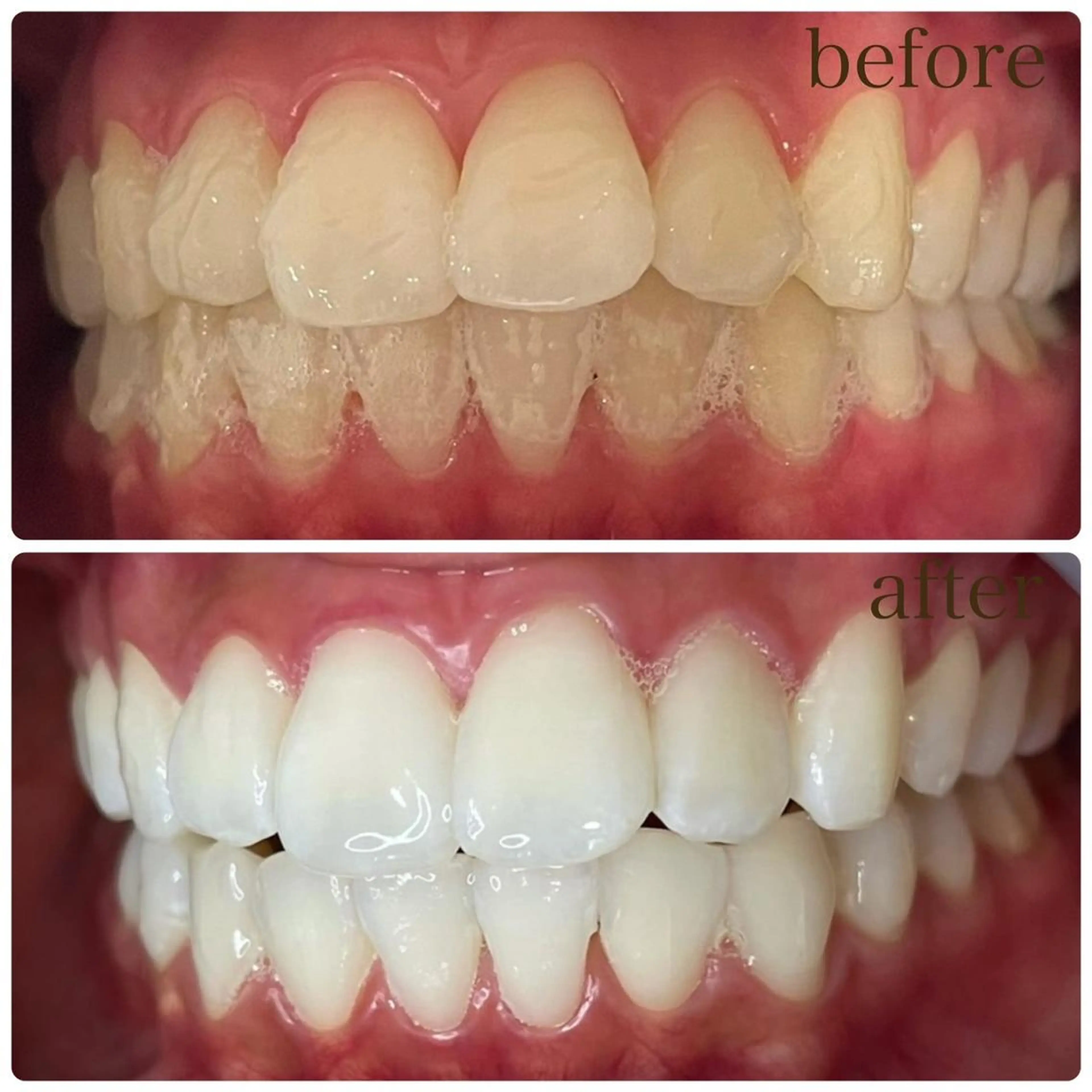 マツエク・マツパ アイブロウ LOVE ホワイトニング下北沢のエステ・リラクイメージ