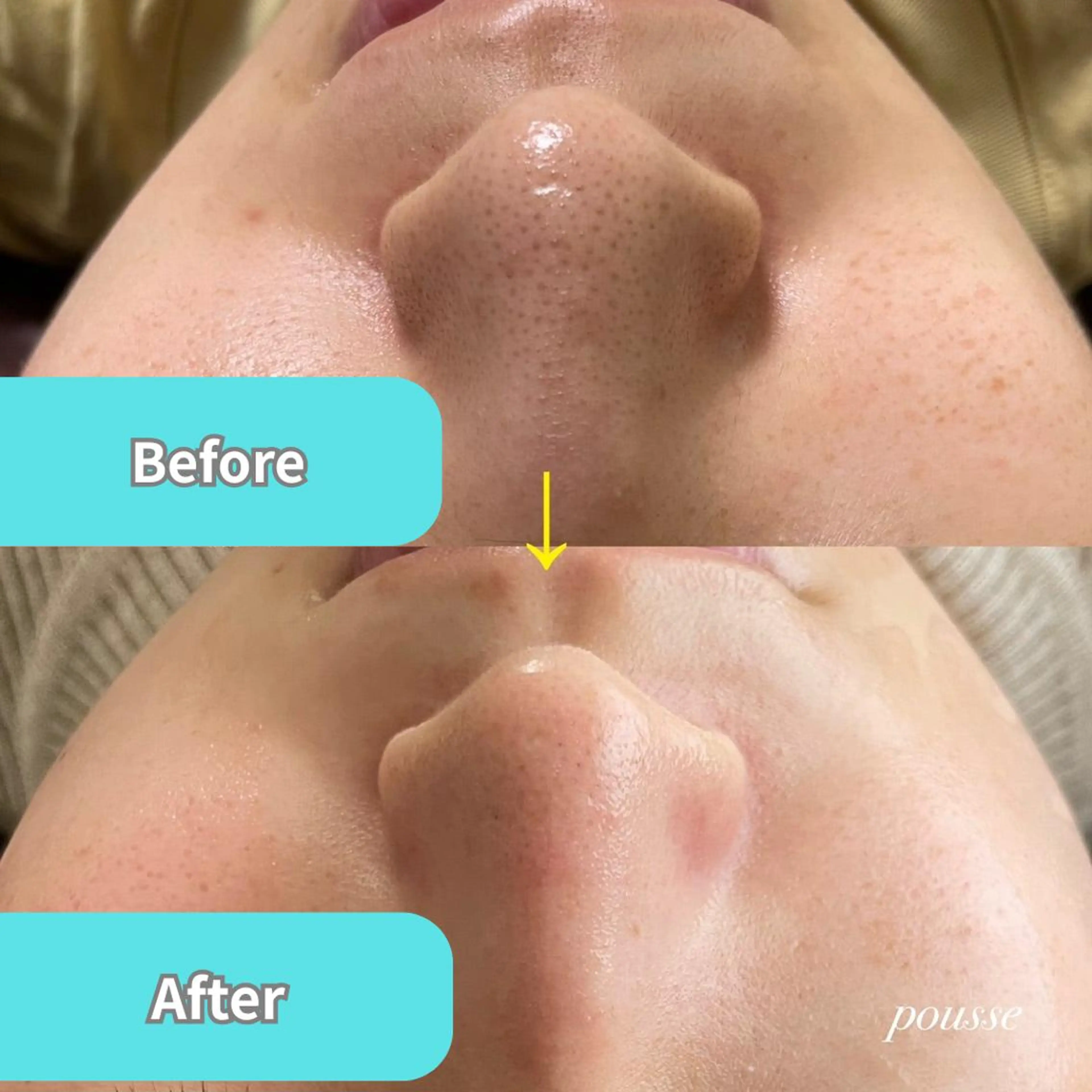 TWINKLE上尾店 Shimadaのエステ・リラクイメージ