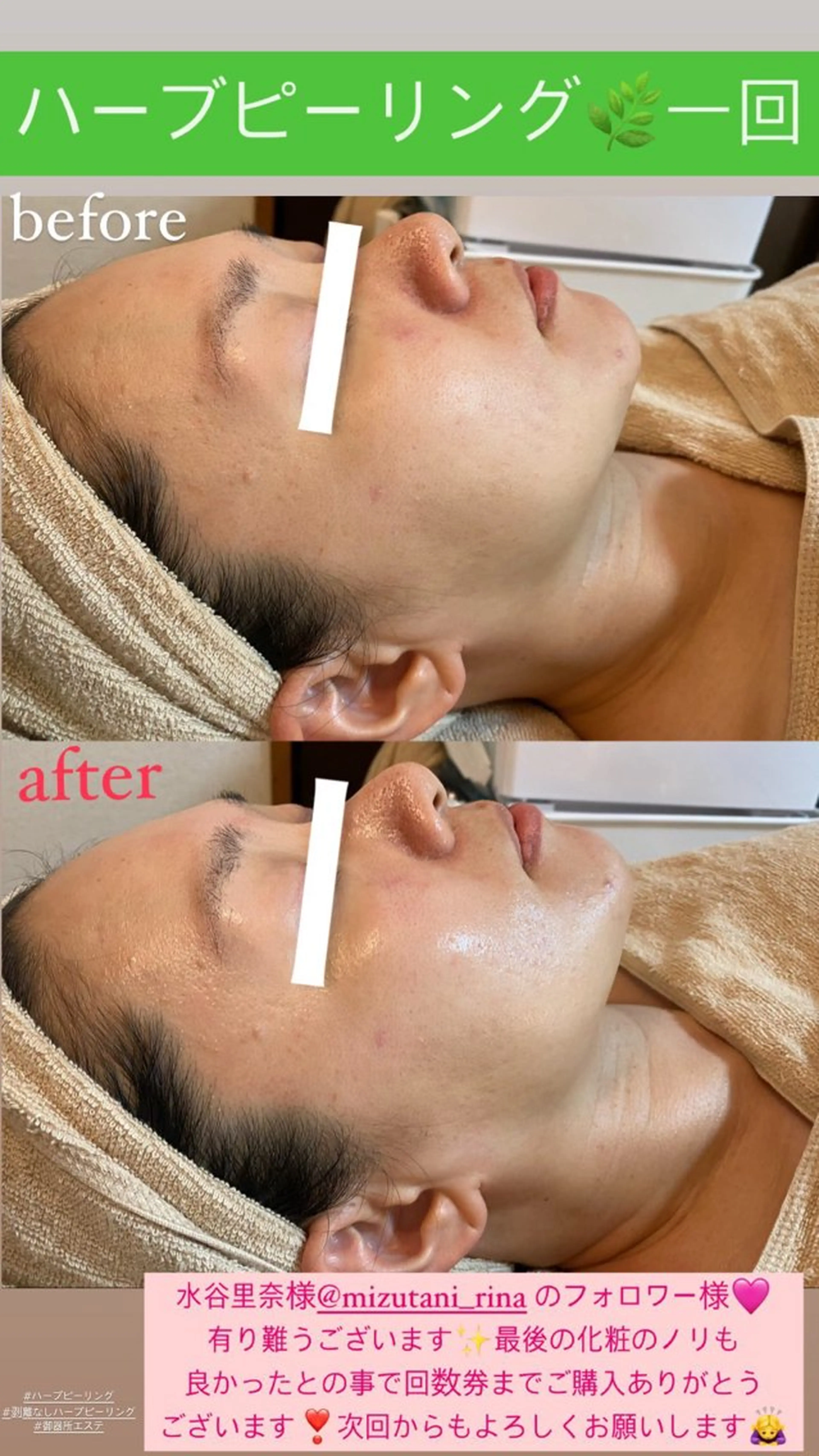 エステ Salon de Lino 御器所のエステ・リラクイメージ