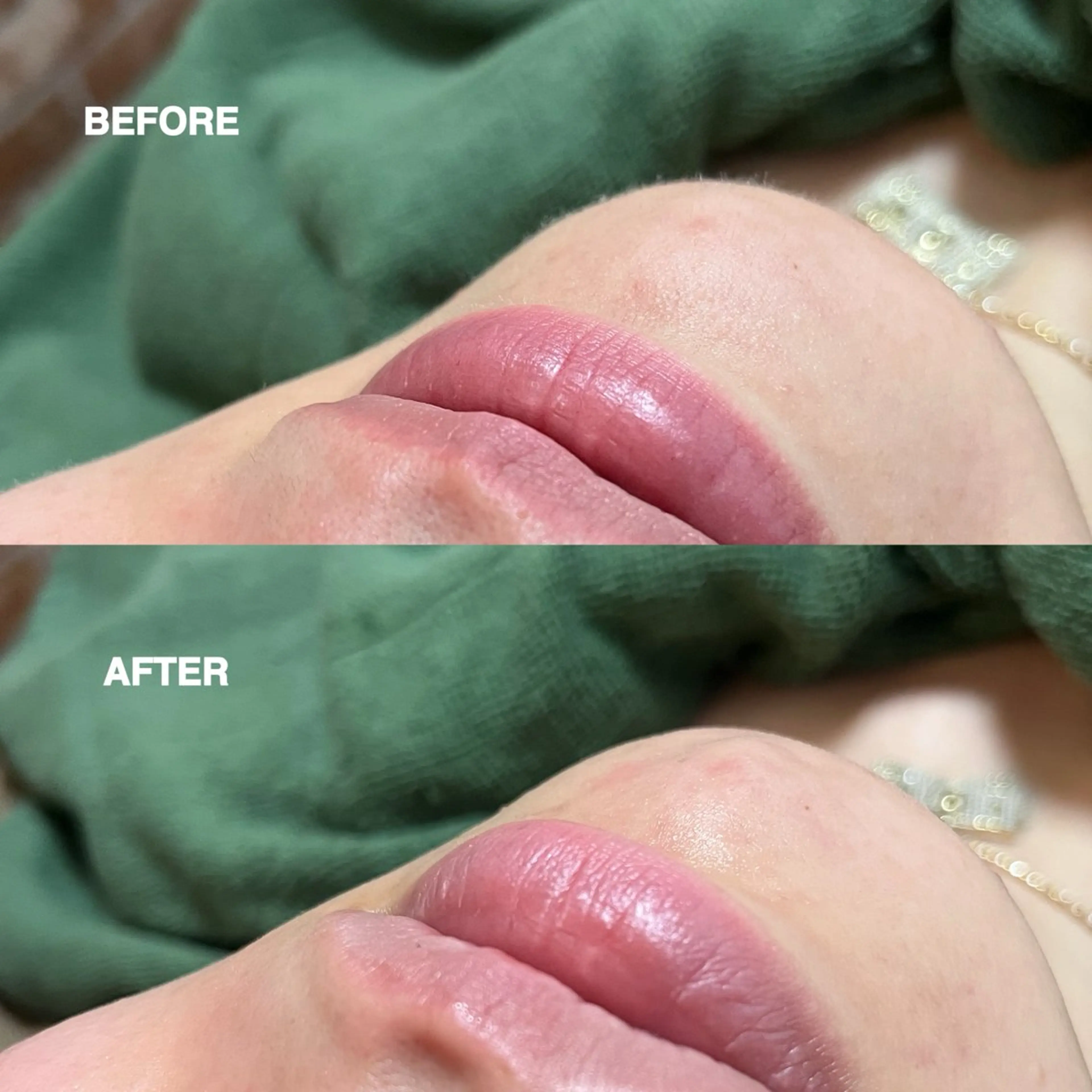 お顔そりルーム小春空所属・＊ HARUKAのその他イメージ