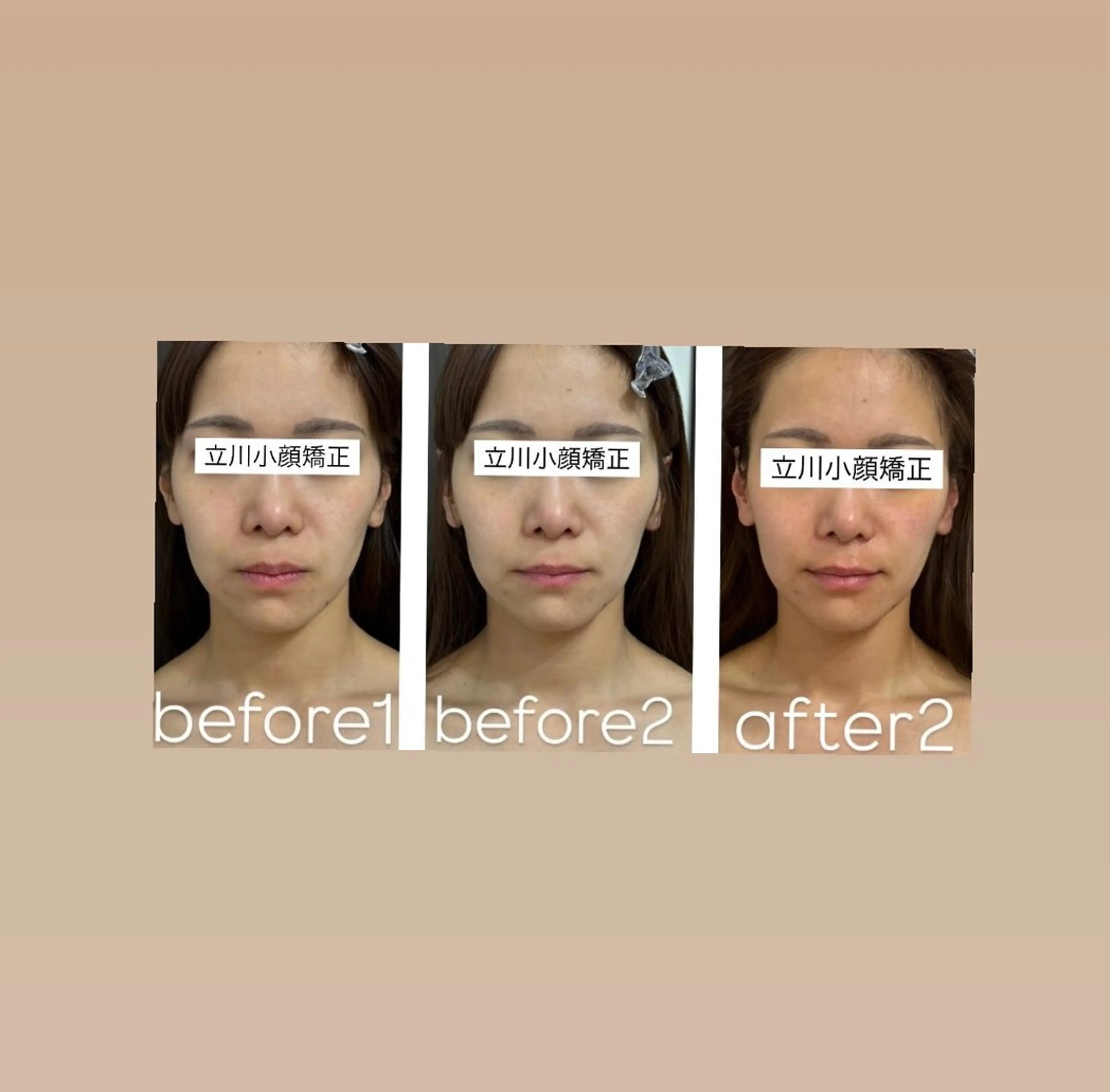 頭蓋骨小顔矯正 極眠ドライヘッド専門のエステ・リラクイメージ