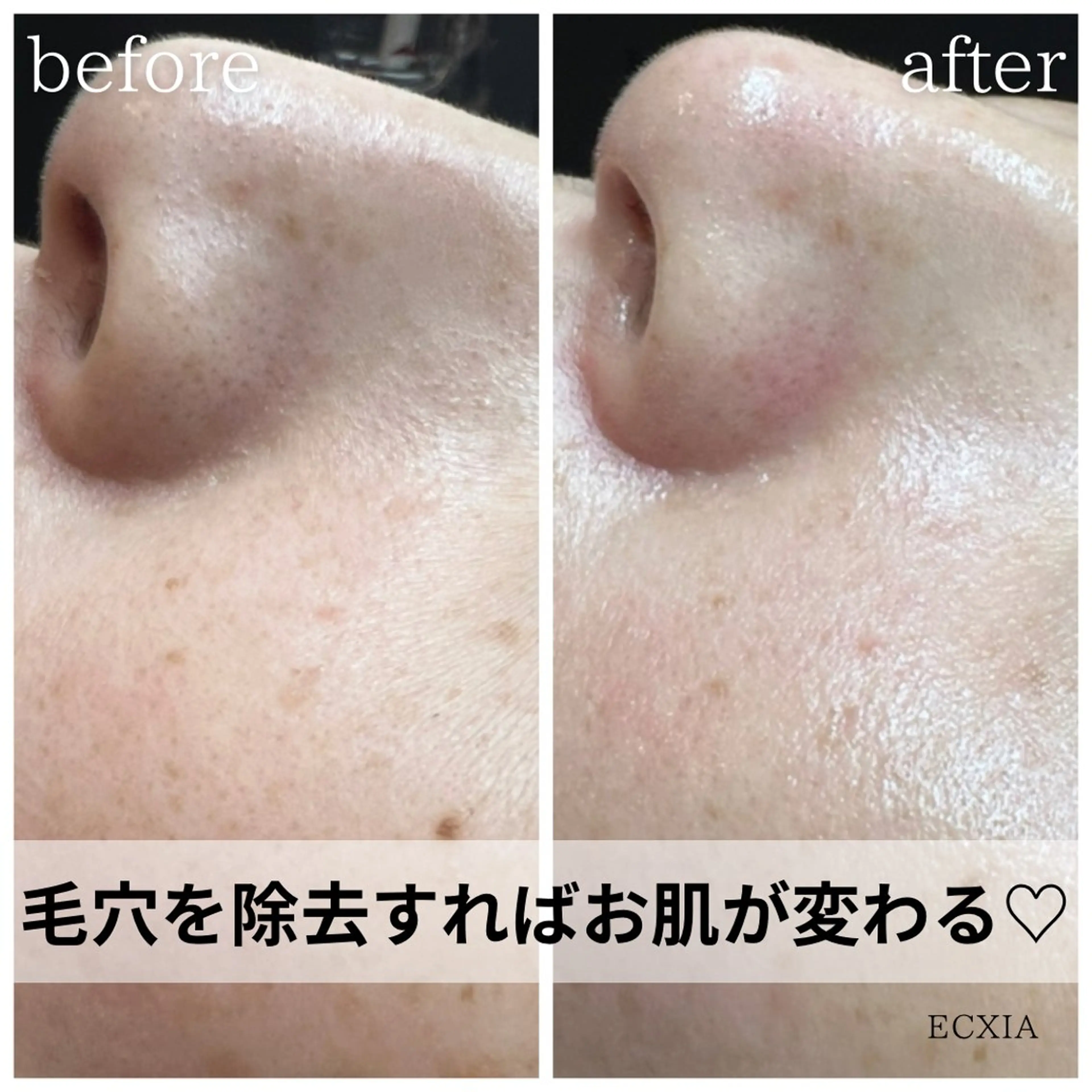 ECXIA 【エクシア】のエステ・リラクイメージ