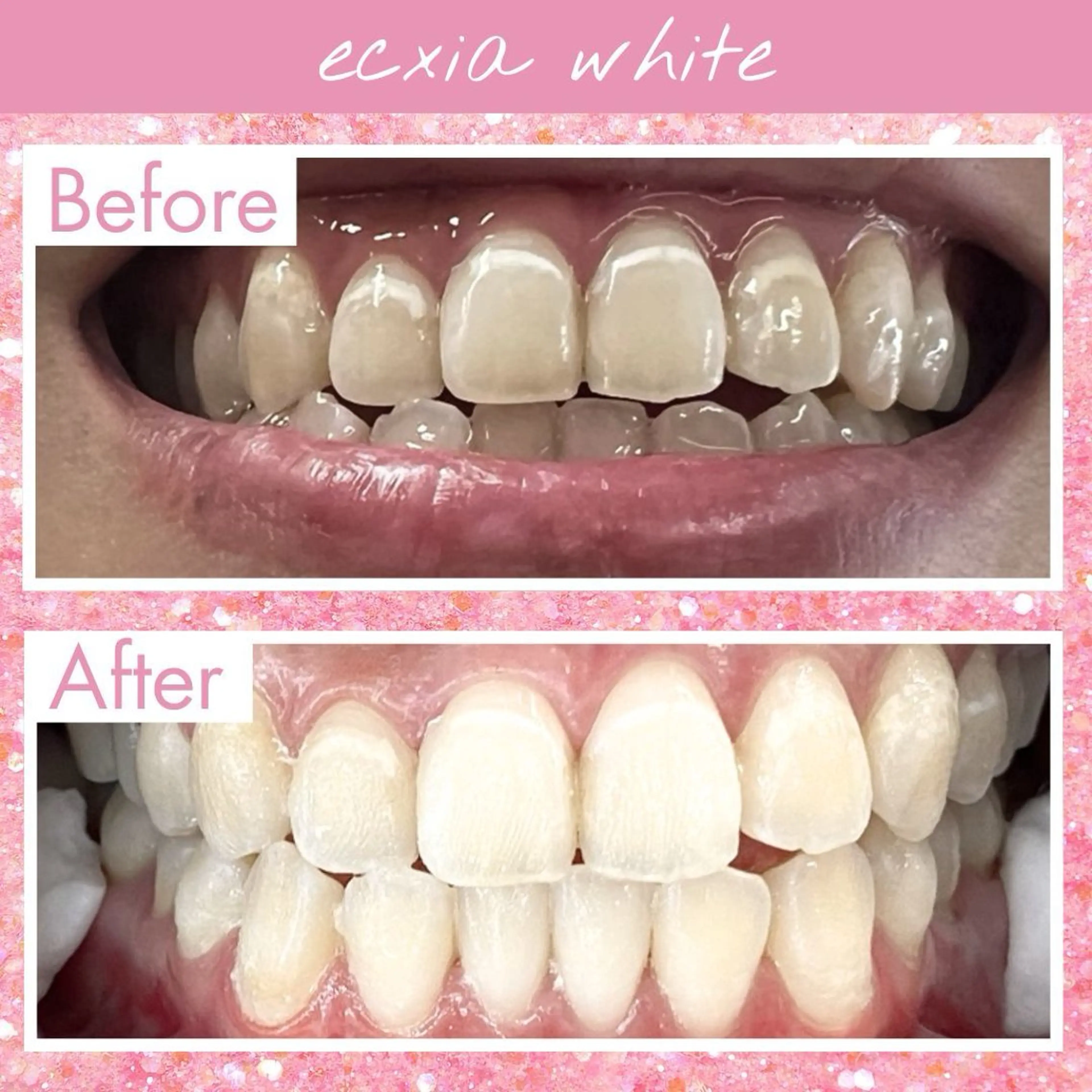 その他 libuR total beauty salon所属・エクシアホワイト 碧南店りりかのその他イメージ