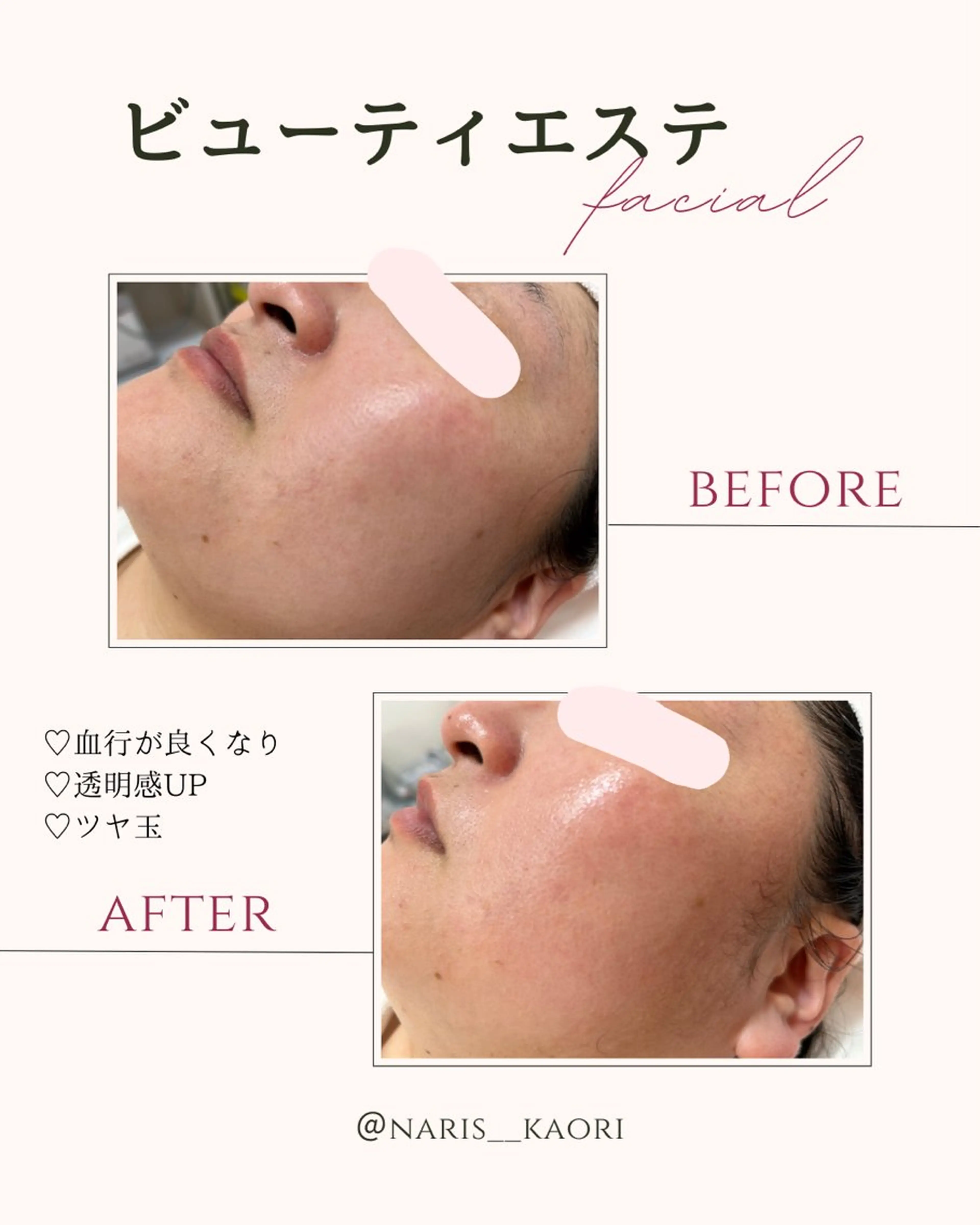 エステ フェイシャルエステ♡ KAORIのエステ・リラクイメージ