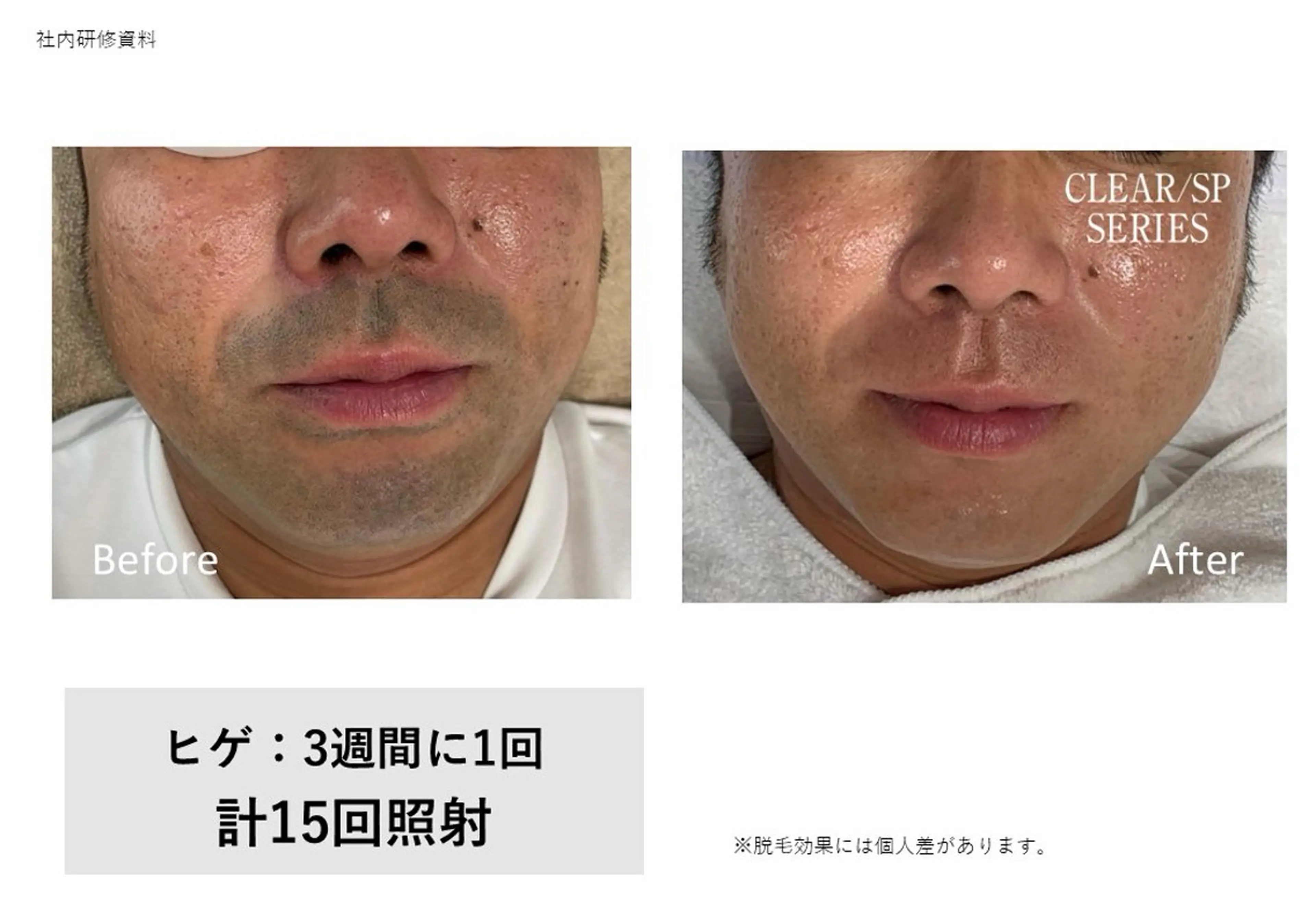 メンズ 脱毛 LeCoeur喜多町 松本のエステ・リラクイメージ