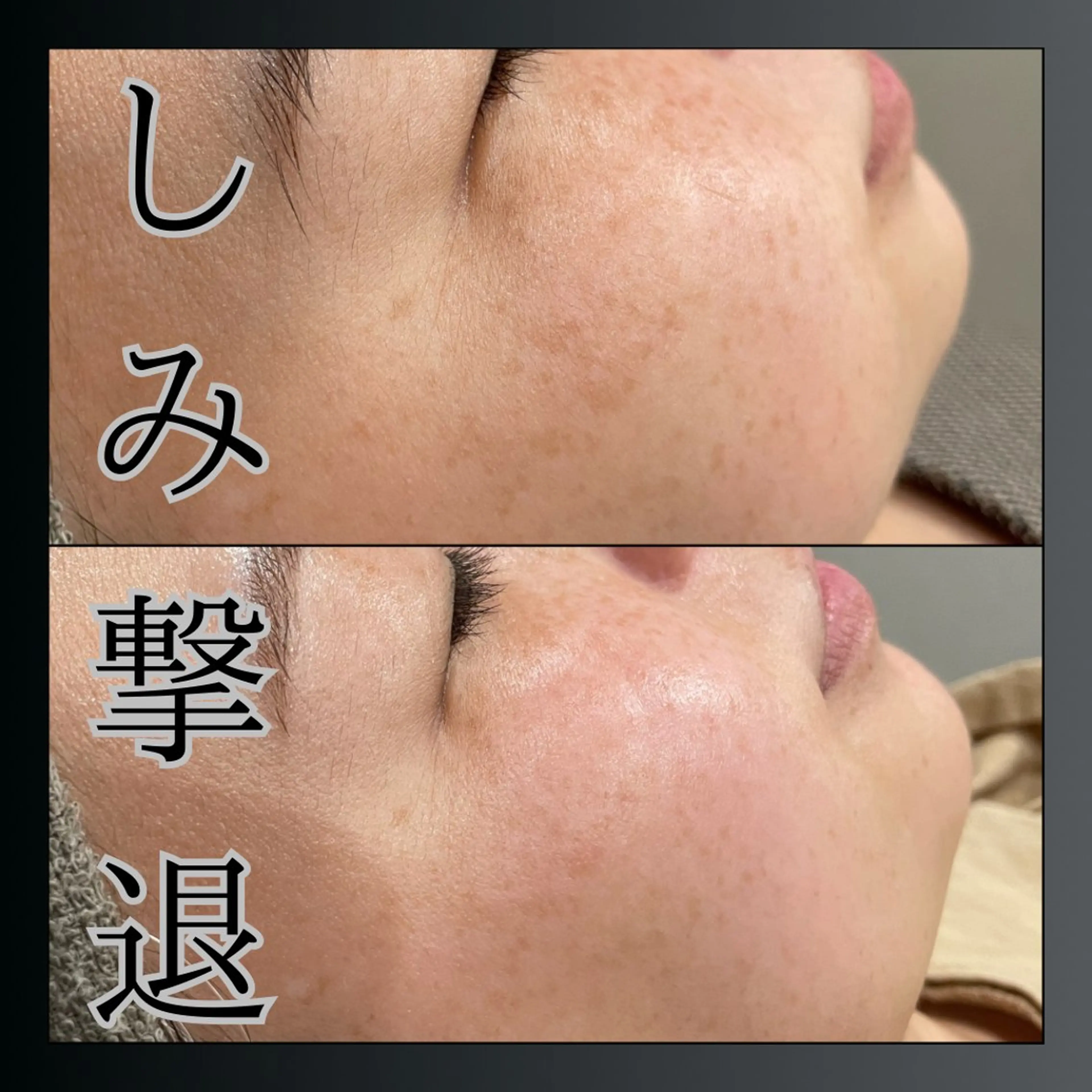 LiZA エステティックサロンのその他イメージ