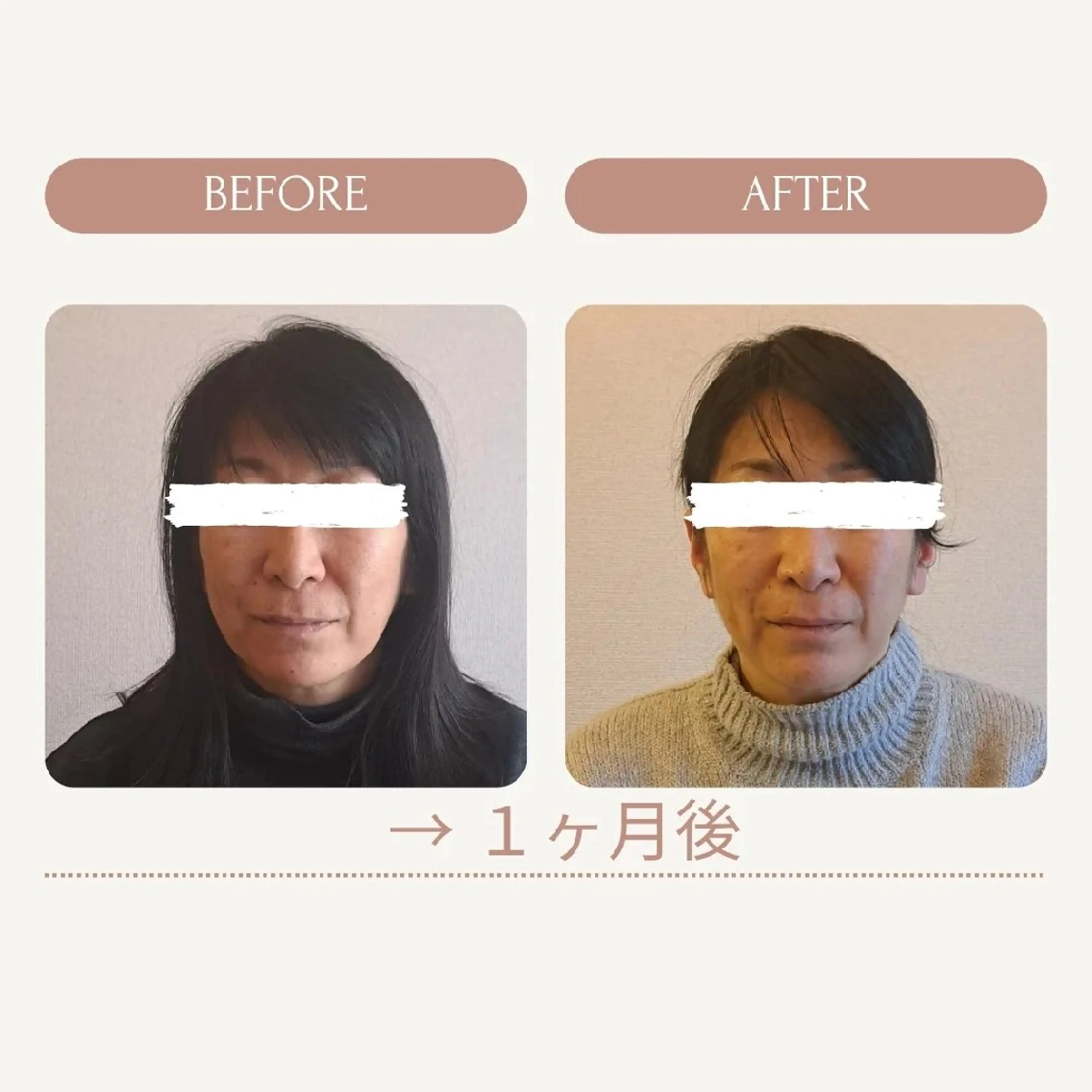 エステ リラク 鍼灸サロンmiyabi所属・美容鍼×エステ　鍼灸 サロンmiyabiのエステ・リラクイメージ