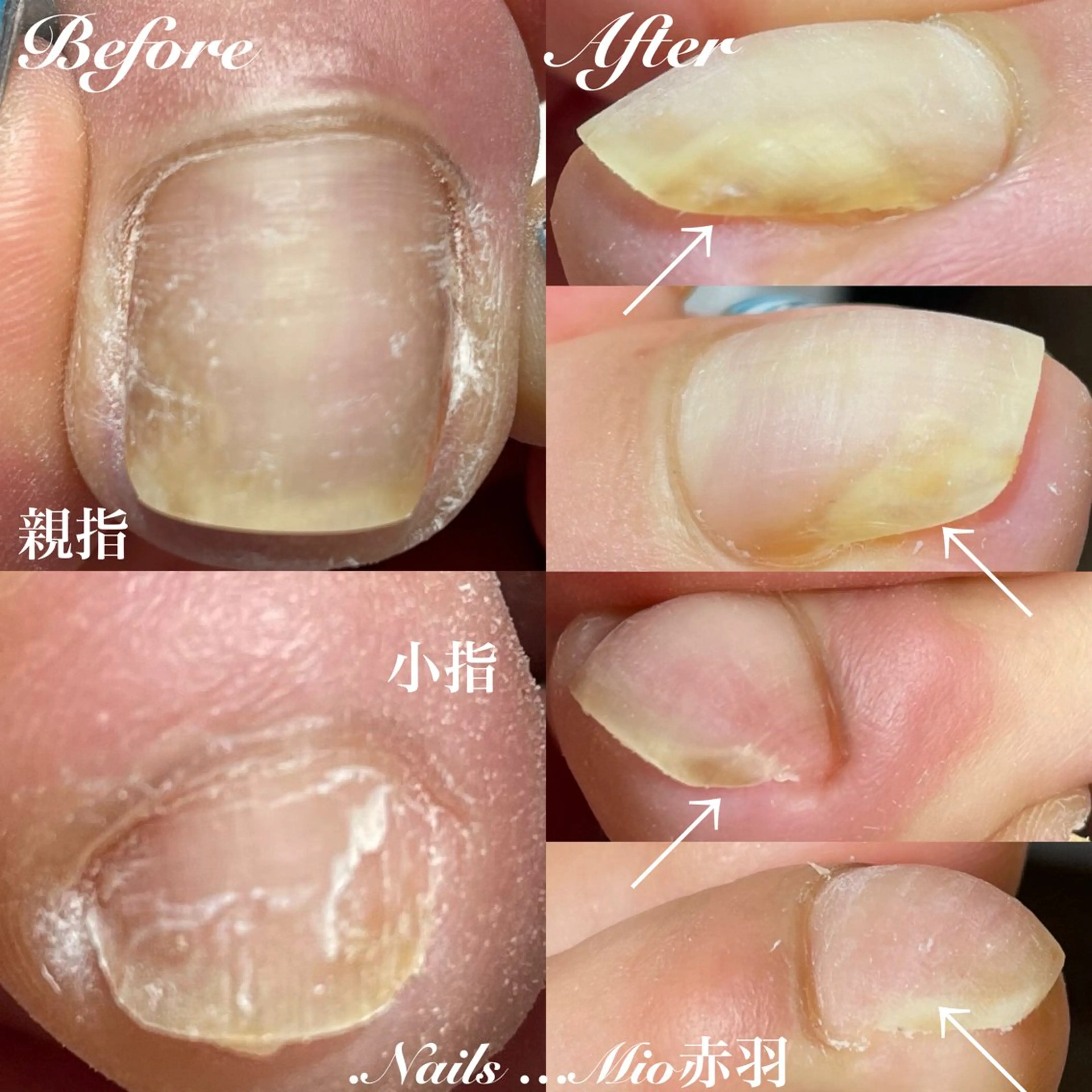 ネイル フットネイル フットネイル .Nails Mio 赤羽西ネイルサロンのネイルデザイン