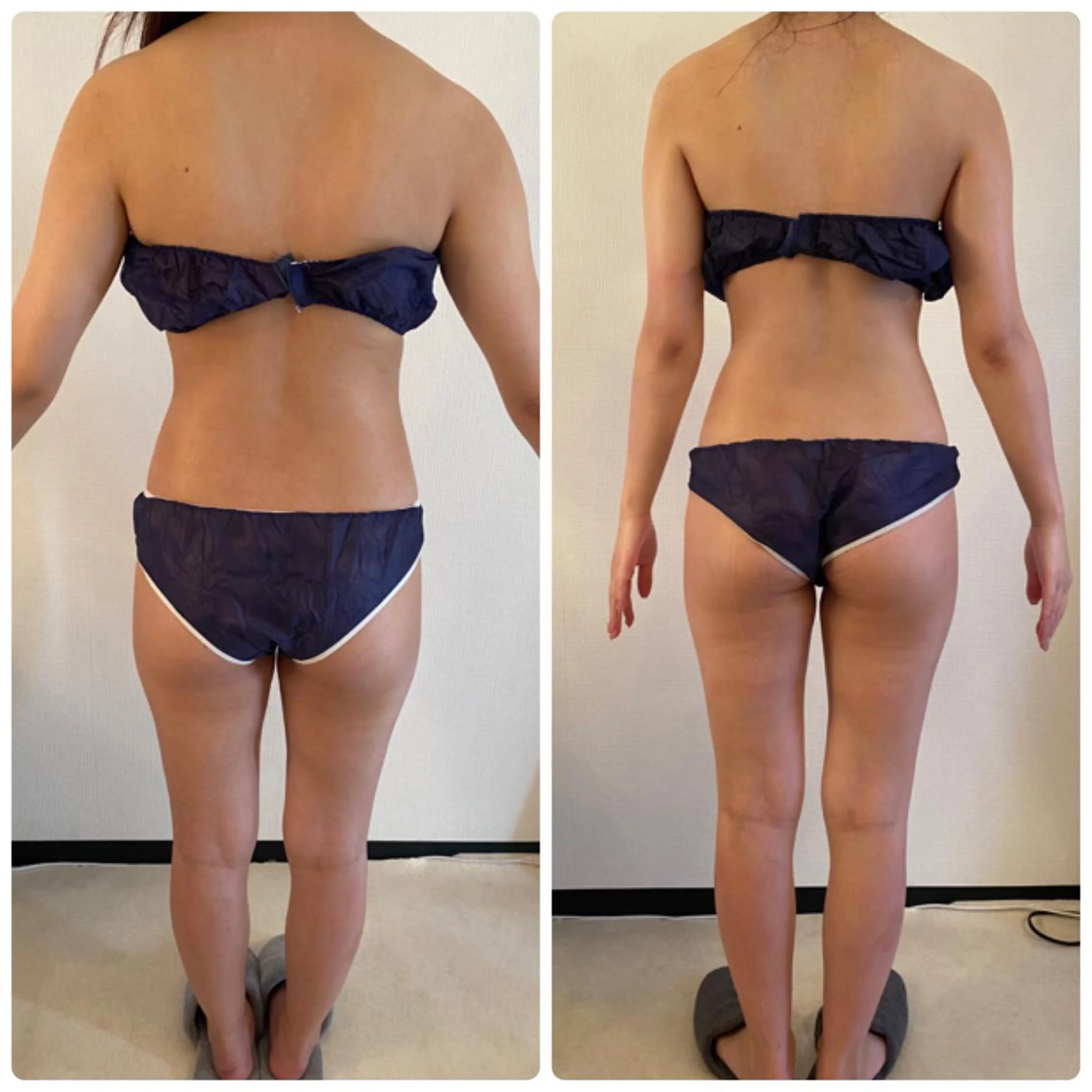 ✨💒本気のブライダルエステ💒✨BODYお試し!ボディ痩身コースの写真