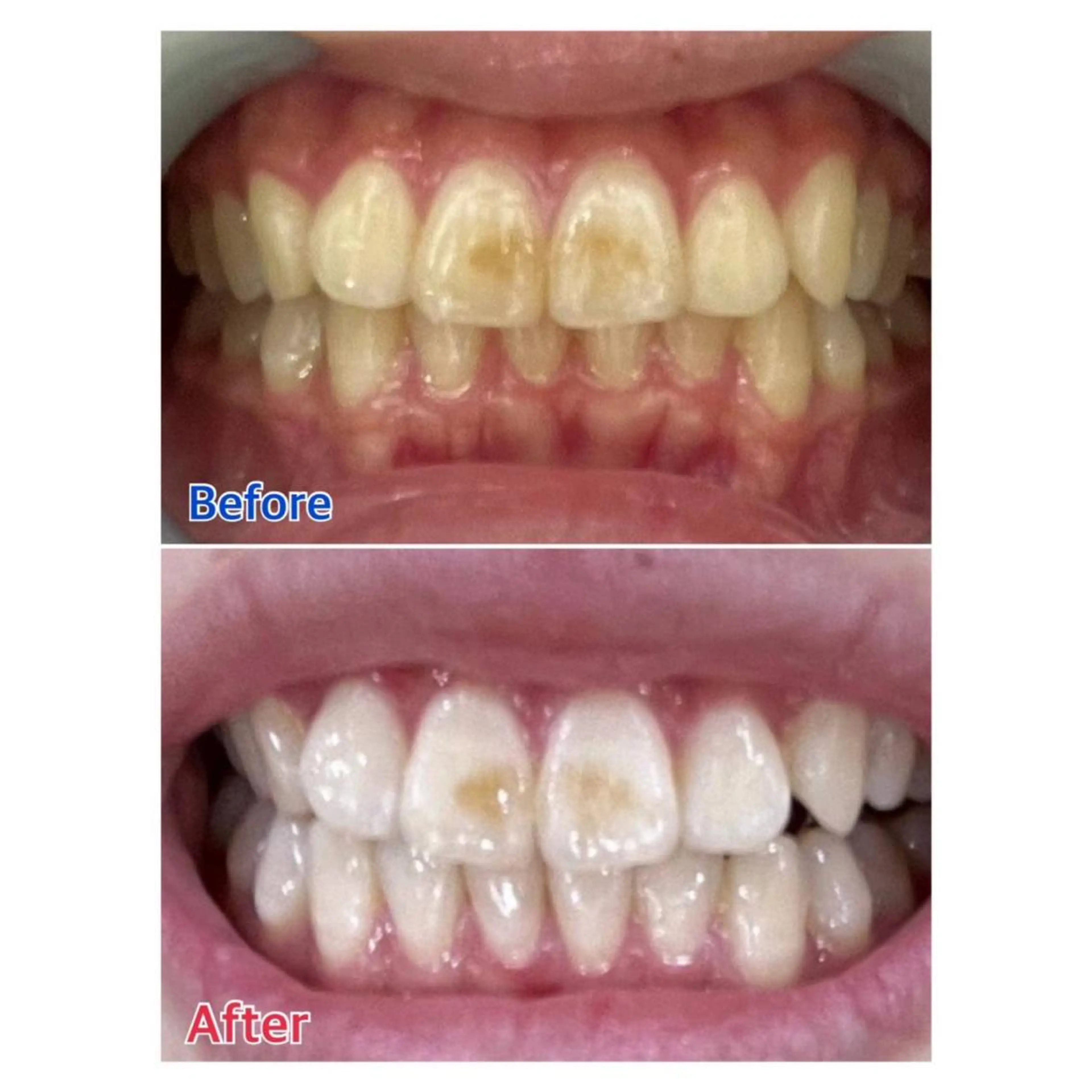 MBEAUTYSALON 千葉店・京成大久保所属・Melty 輝のその他イメージ