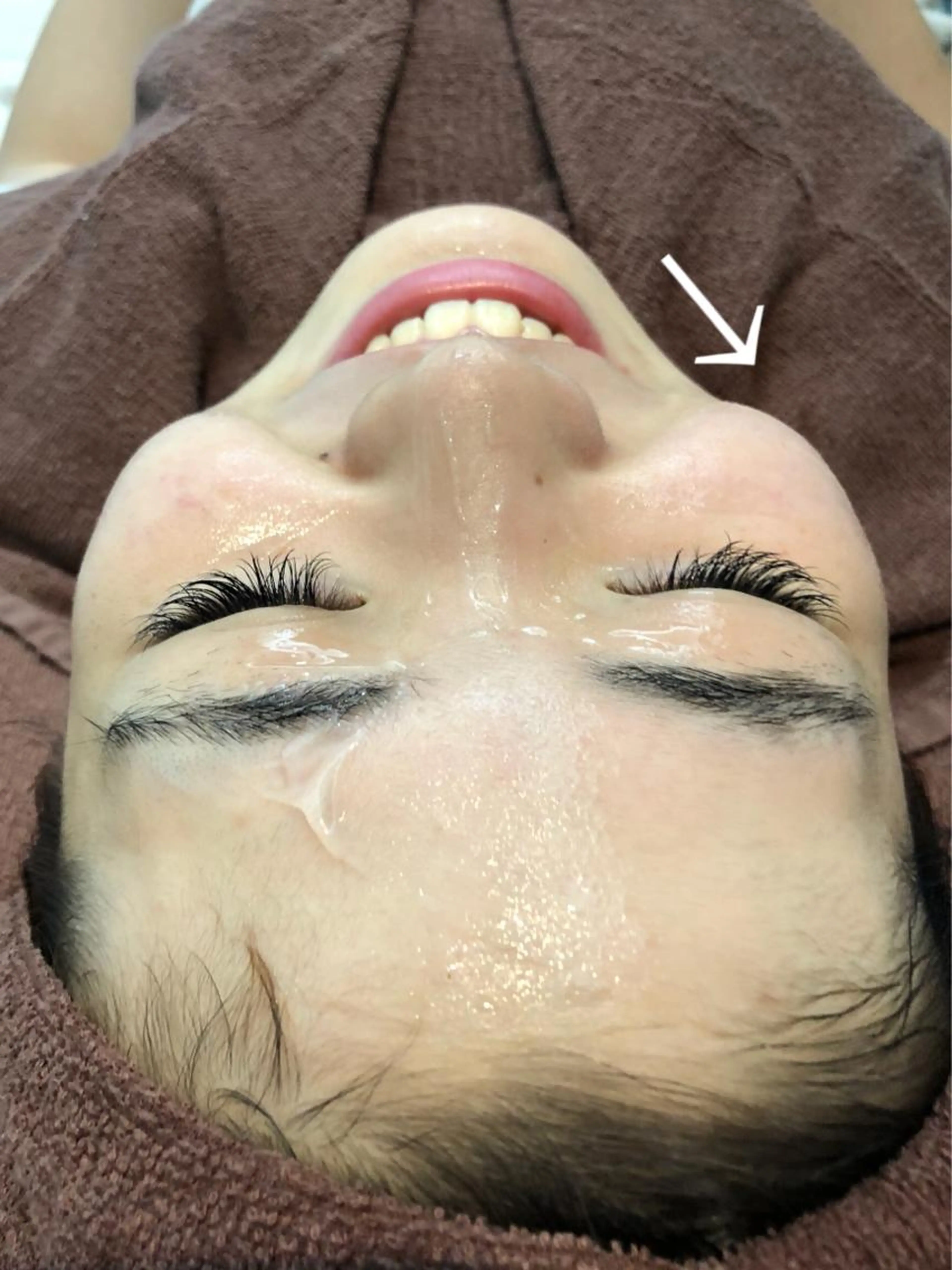 ドクターソワ💆🏻♀️美白エステの写真